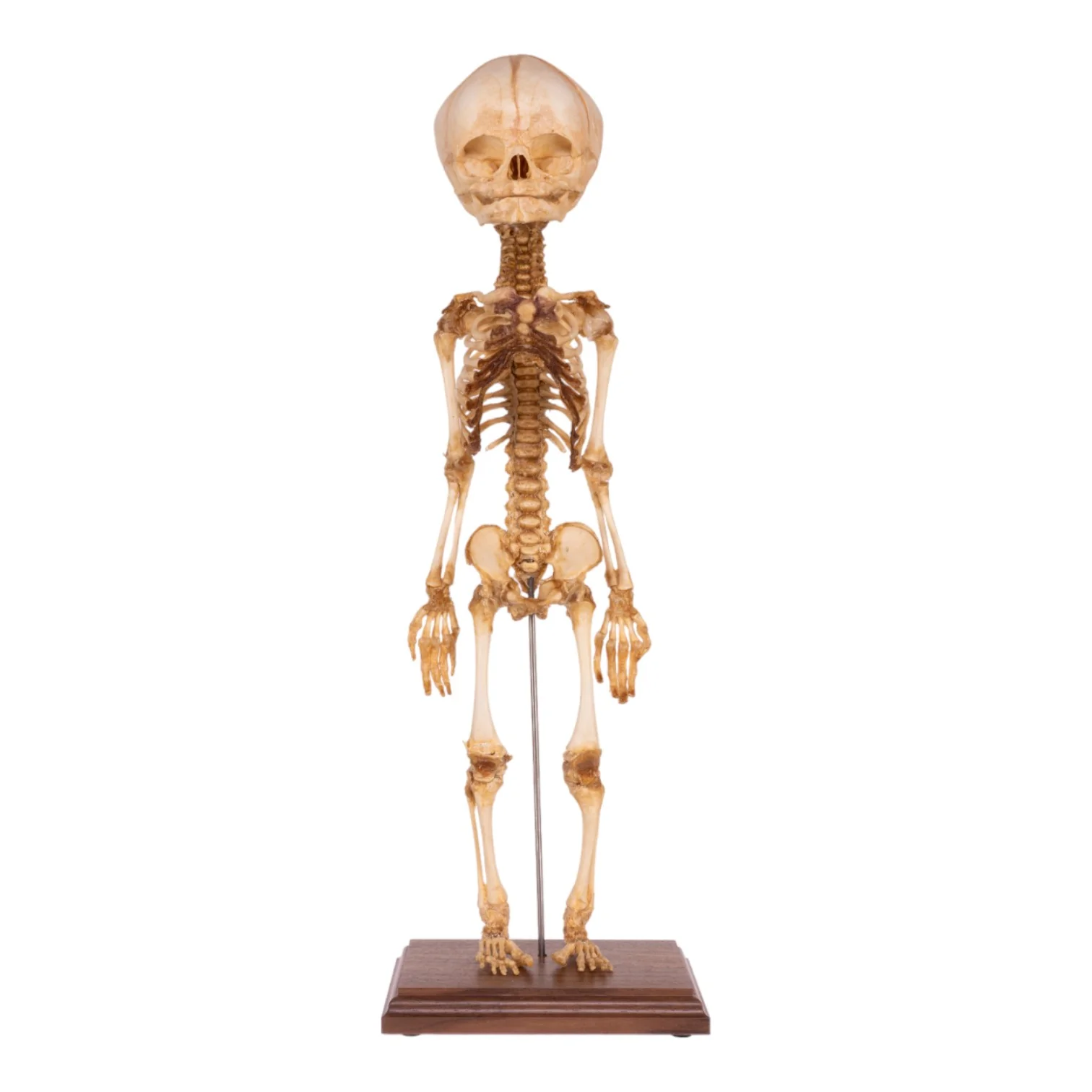 Real Research Quality Human Fetal Articulated Skeleton on Stand - Image 3