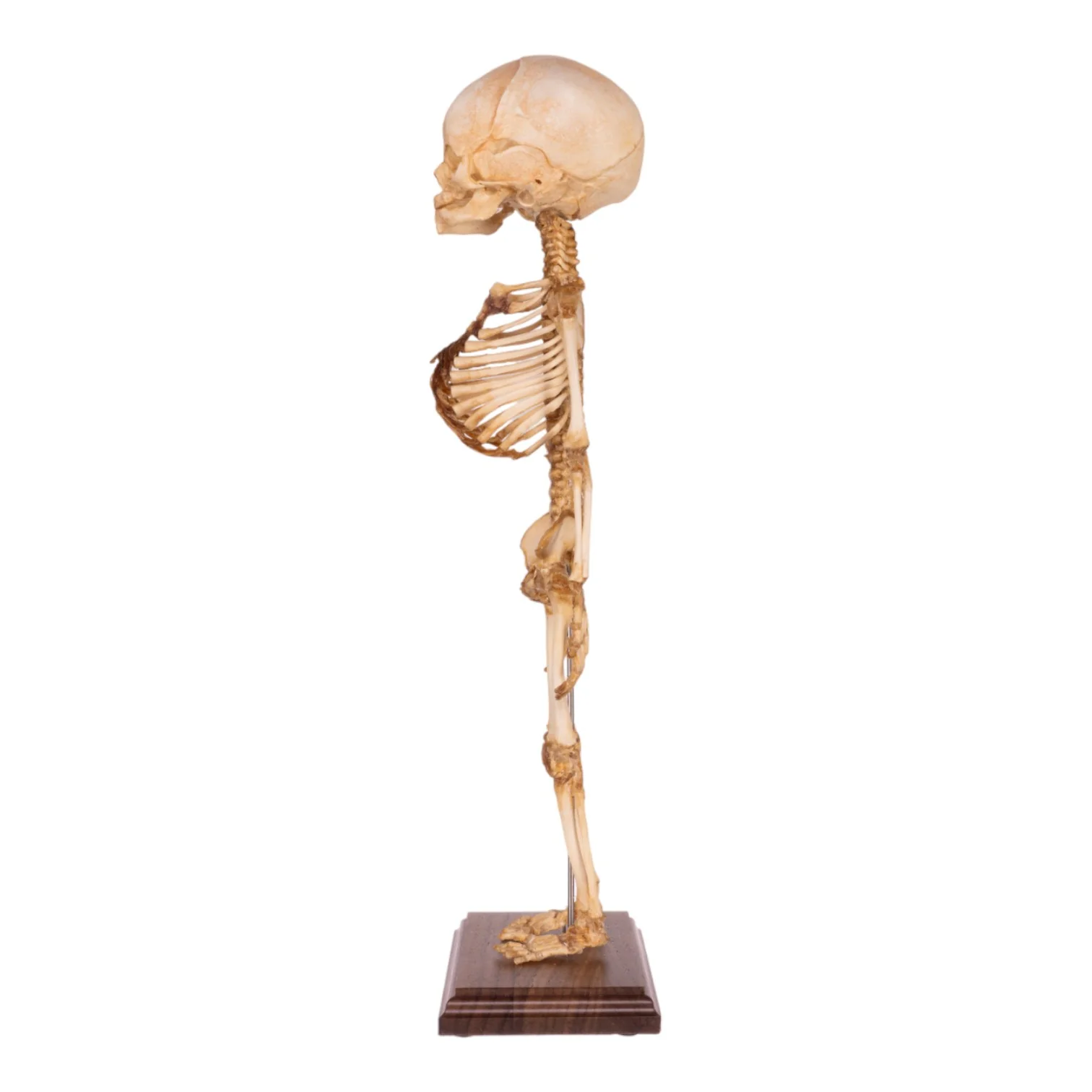 Real Research Quality Human Fetal Articulated Skeleton on Stand - Image 4