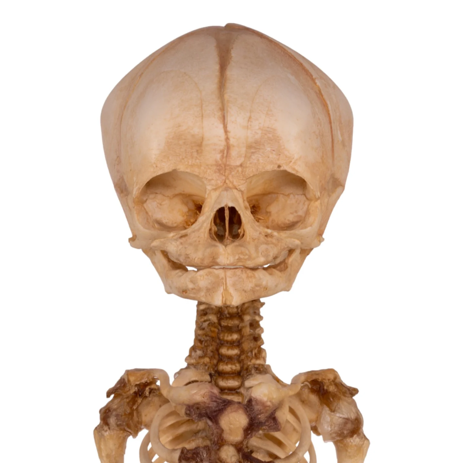 Real Research Quality Human Fetal Articulated Skeleton on Stand - Image 6
