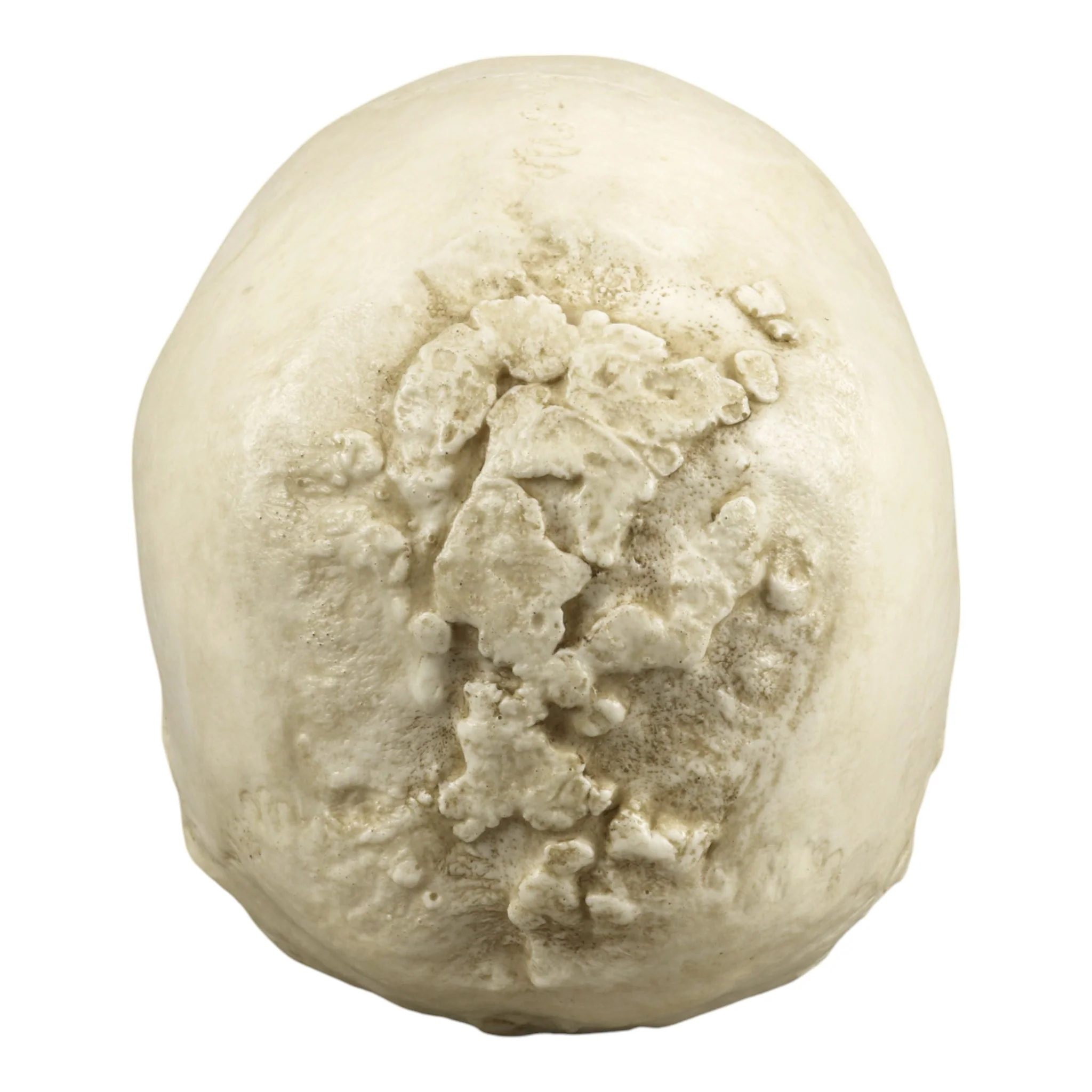 Replica Human Skull with Syphilis - Image 5