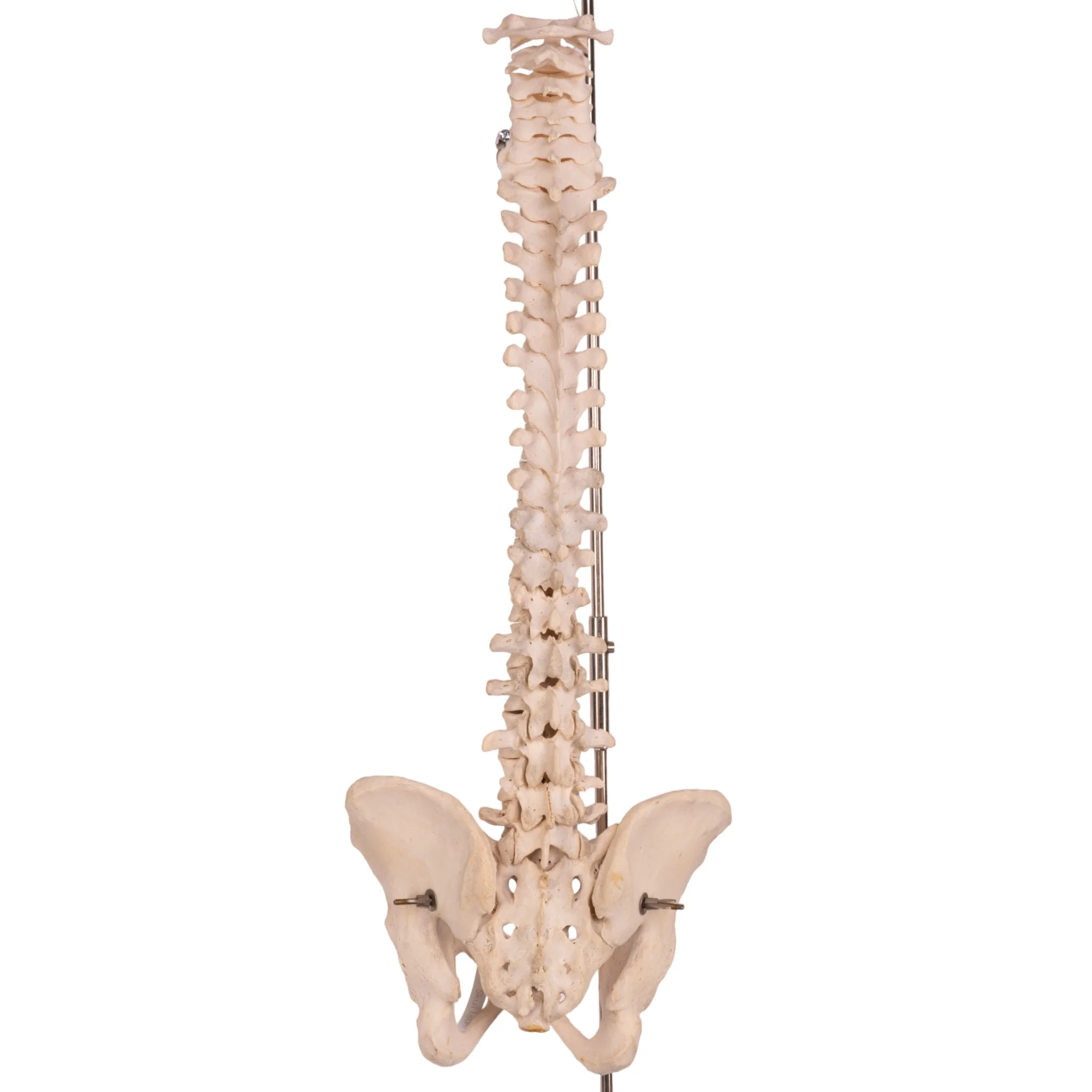 Real Human Spine, Sacrum, and Pelvis - Image 4
