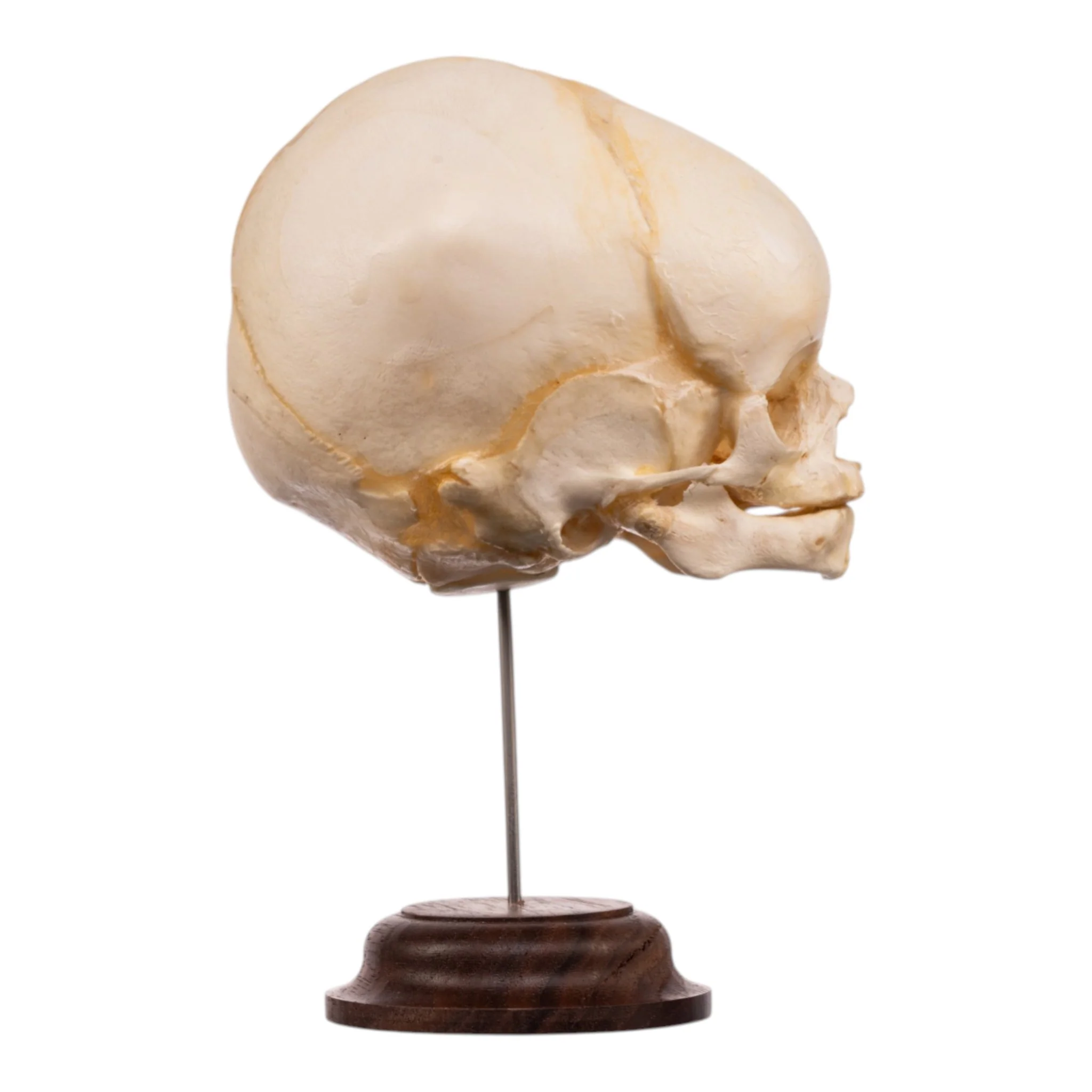 Real Fetal Human Skull on Stand - Image 2