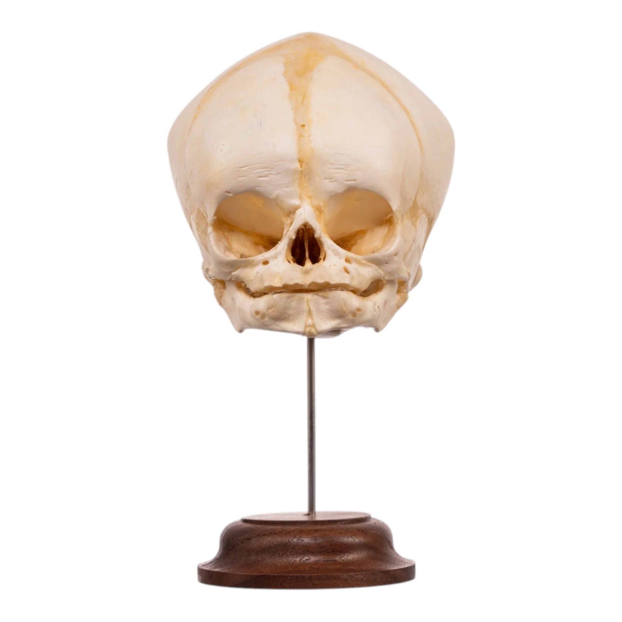 Real Fetal Human Skull on Stand - Image 3