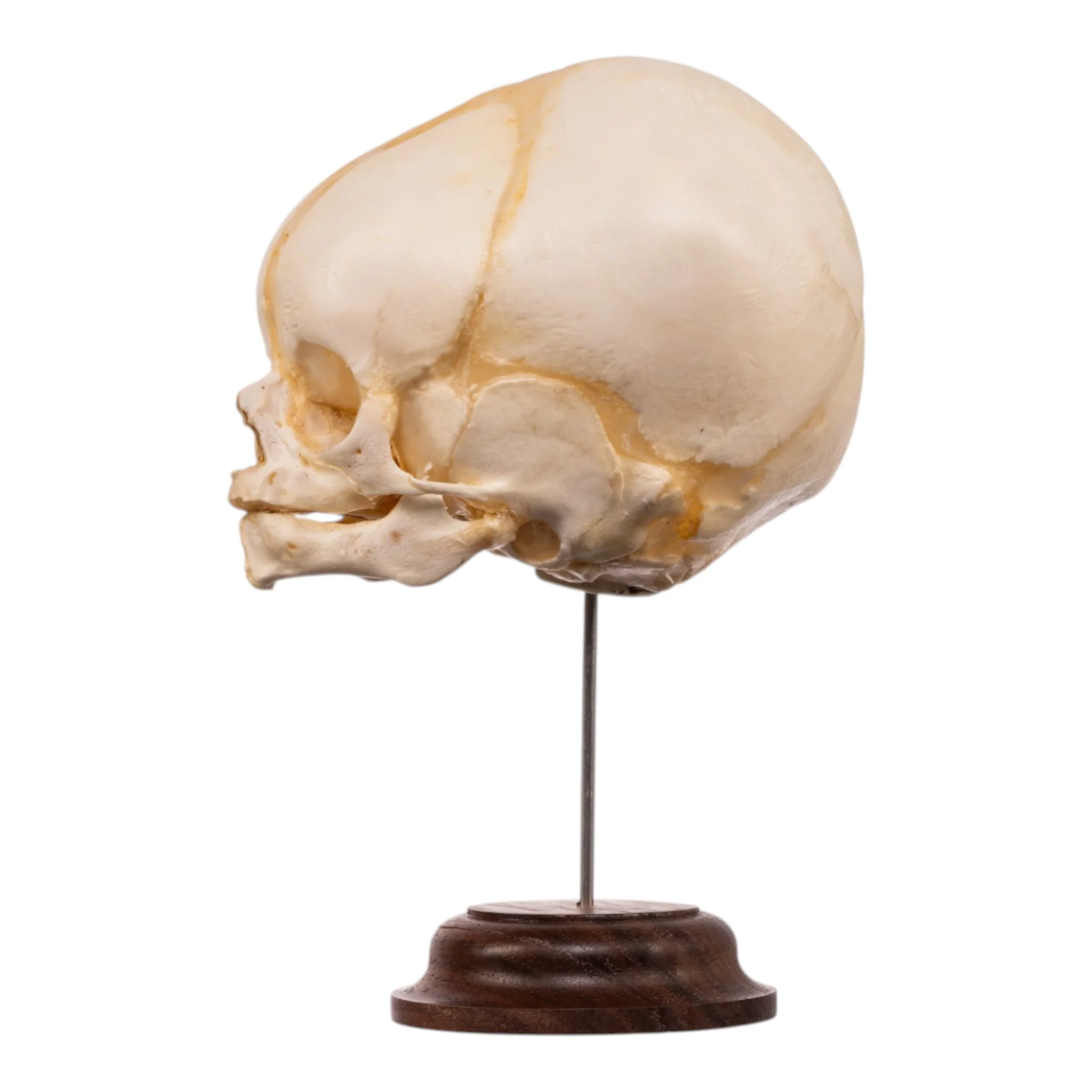 Real Fetal Human Skull on Stand - Image 4