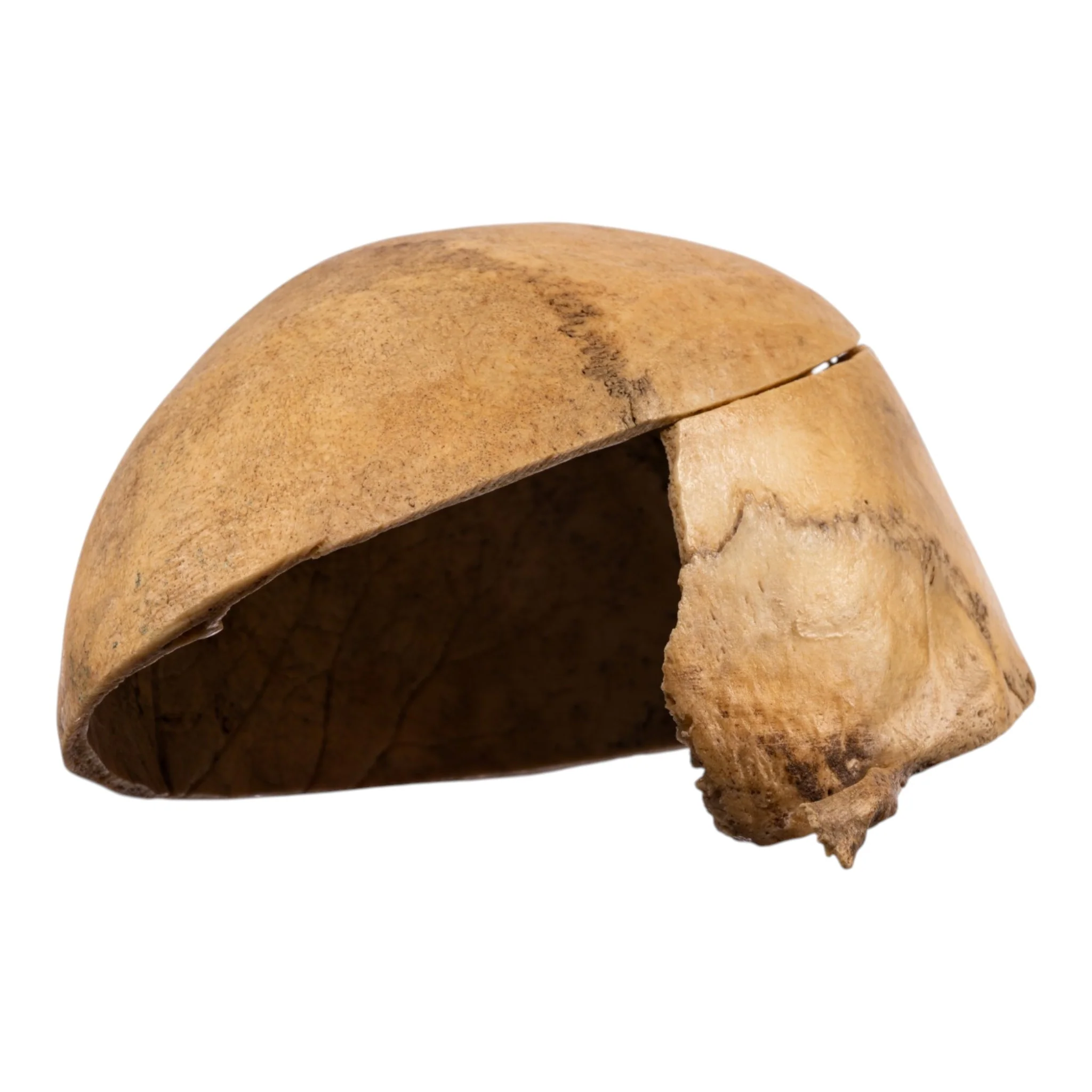 Real Human Calvaria - Image 2