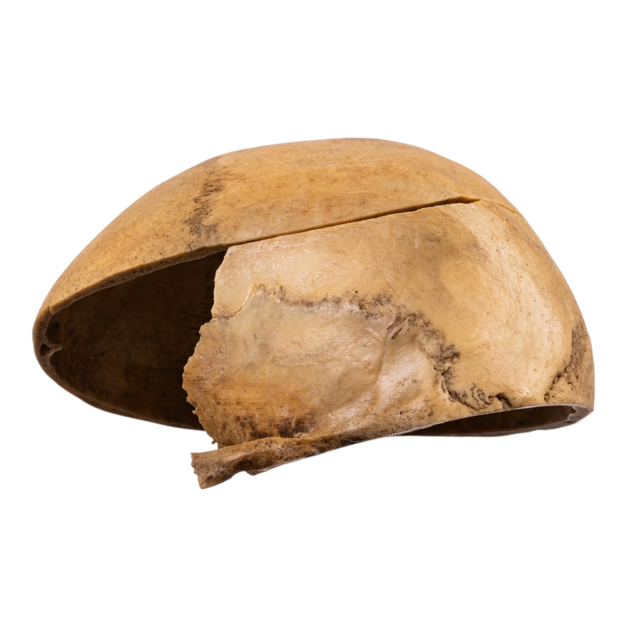 Real Human Calvaria - Image 3