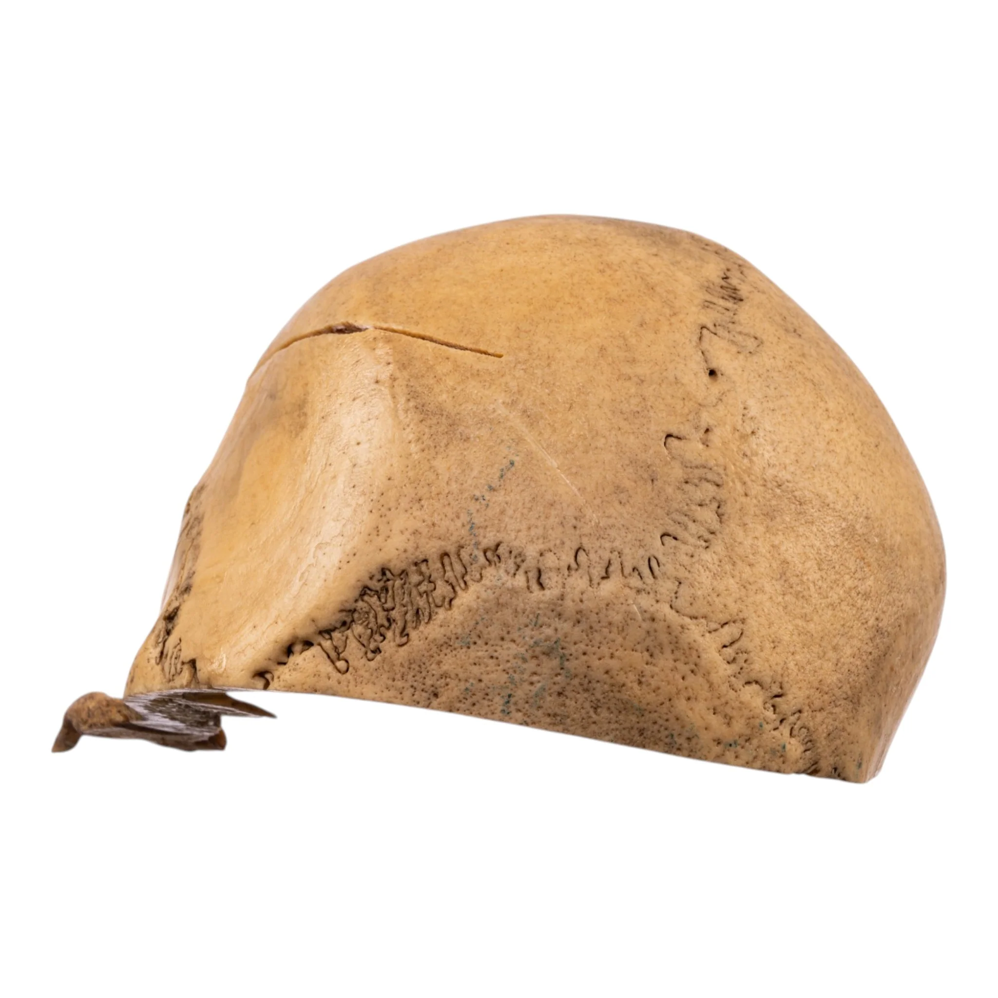 Real Human Calvaria - Image 4