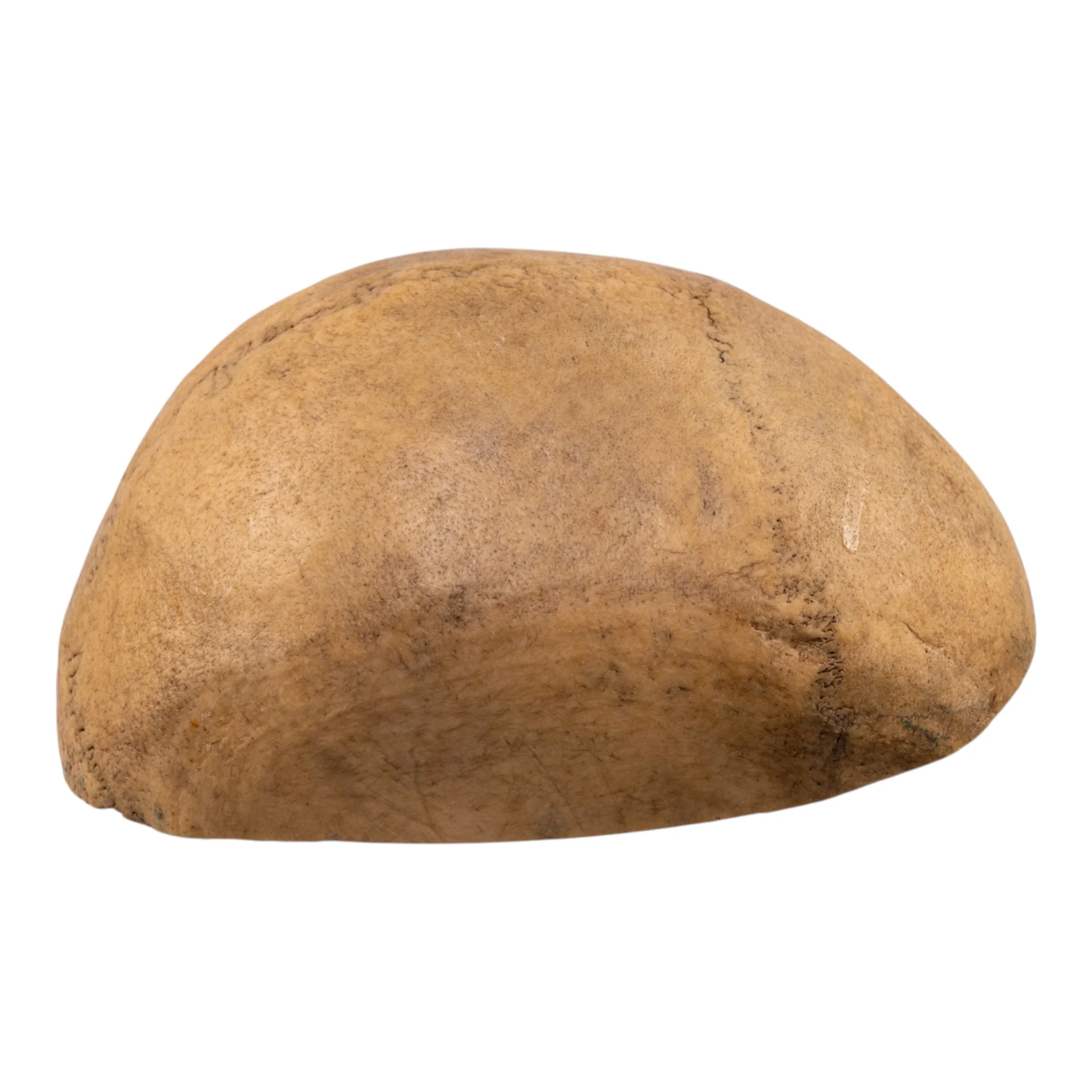 Real Human Calvaria - Image 5