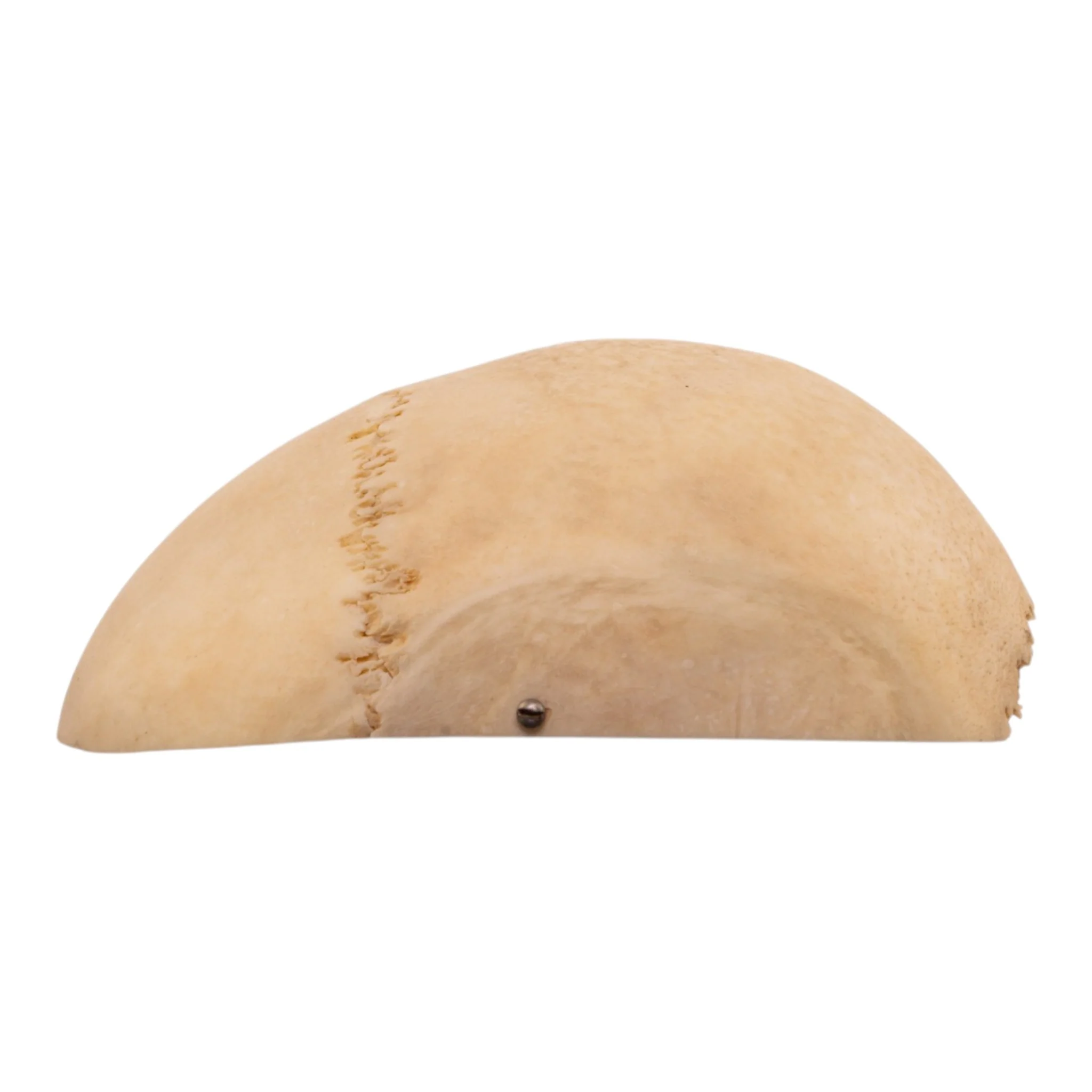 Real Human Calvaria with Hardware - Image 4
