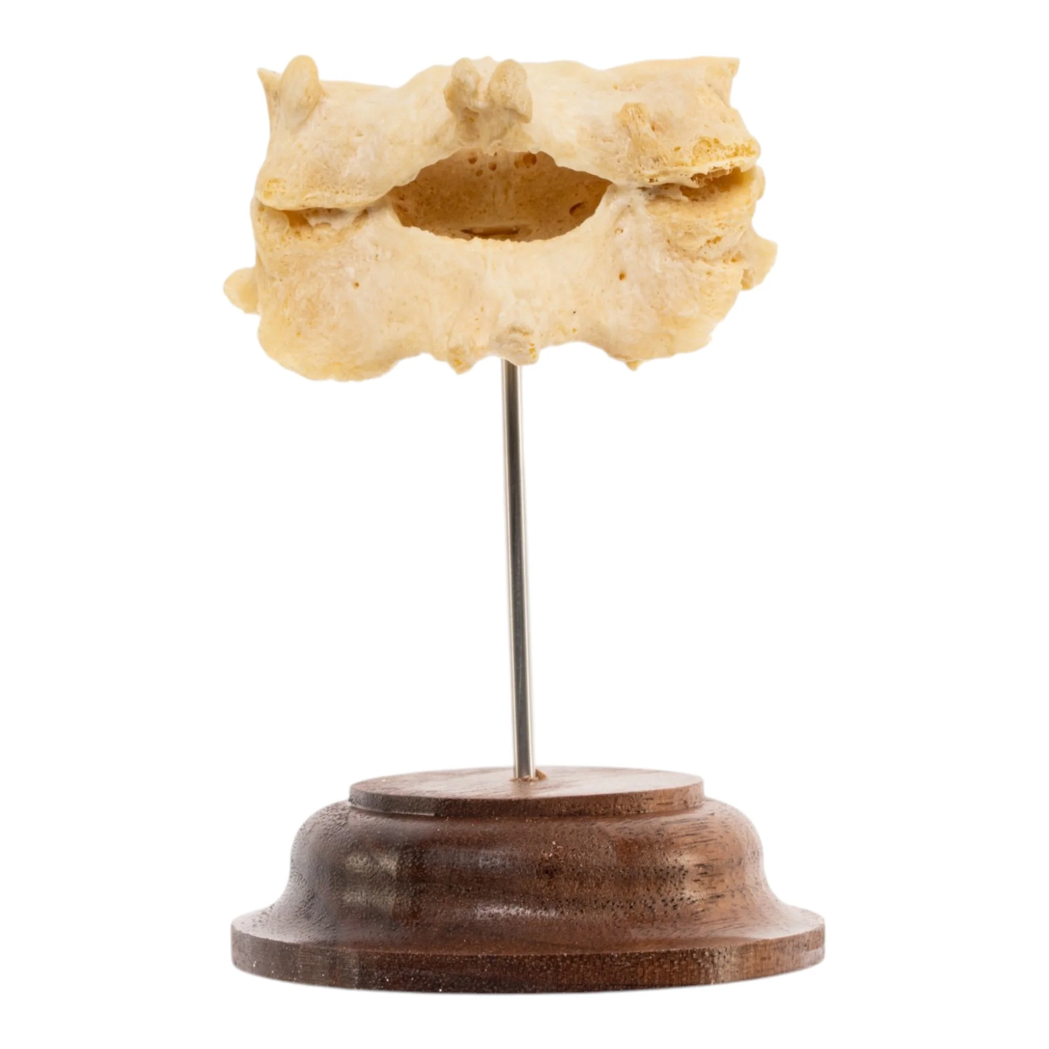 Real Human Cervical Vertebrae - Fused - Image 8