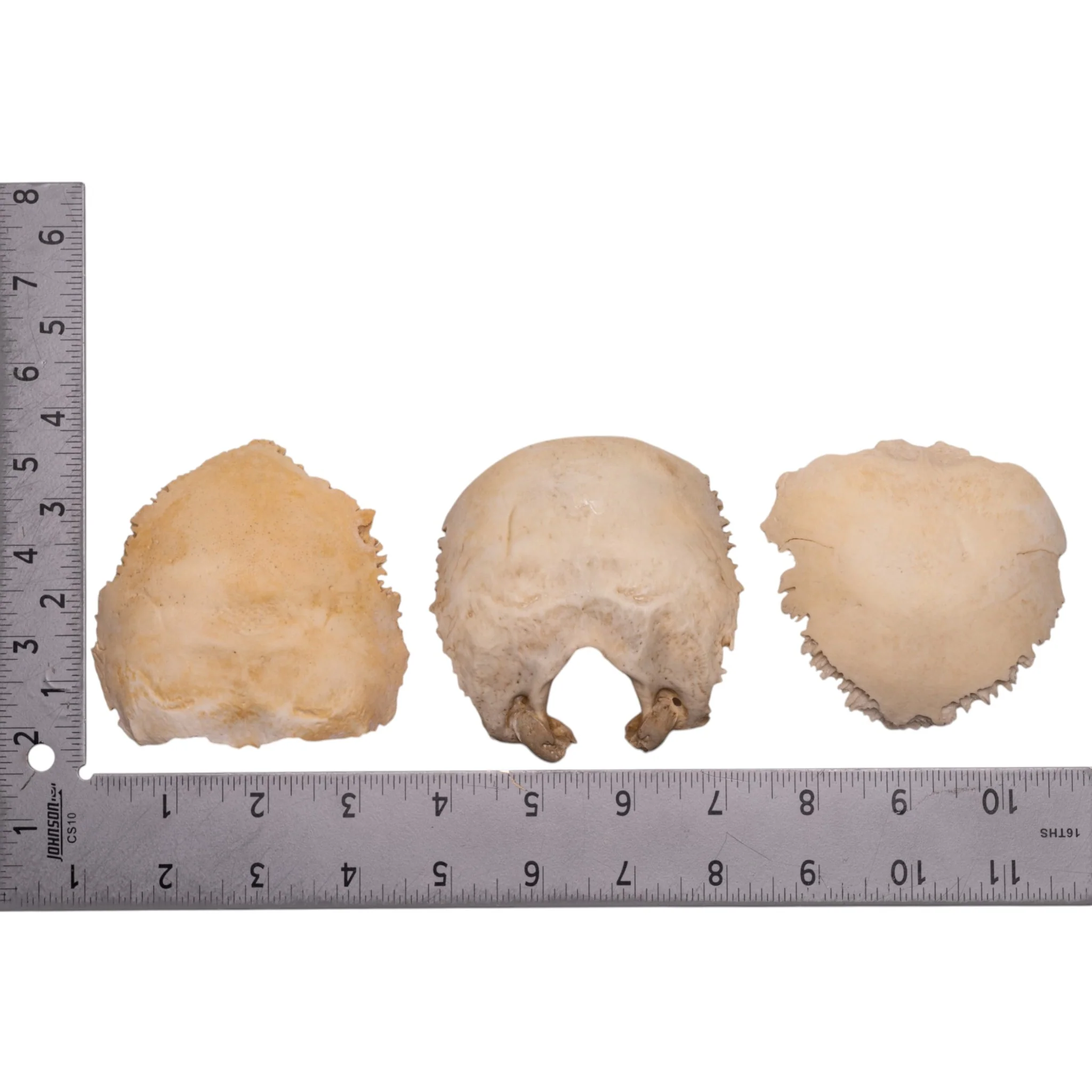 Real Human Child Occipital Bone - Image 2