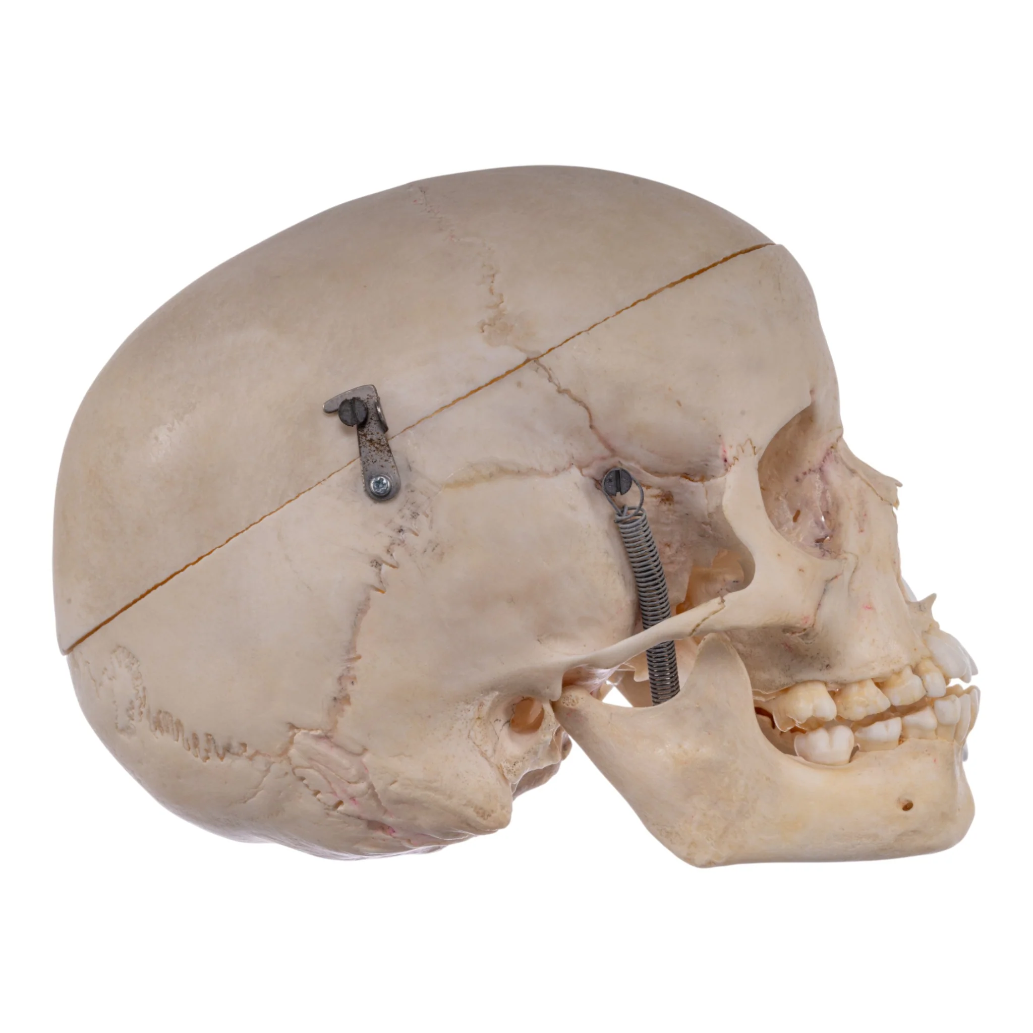Real Human Child Skull - Image 2