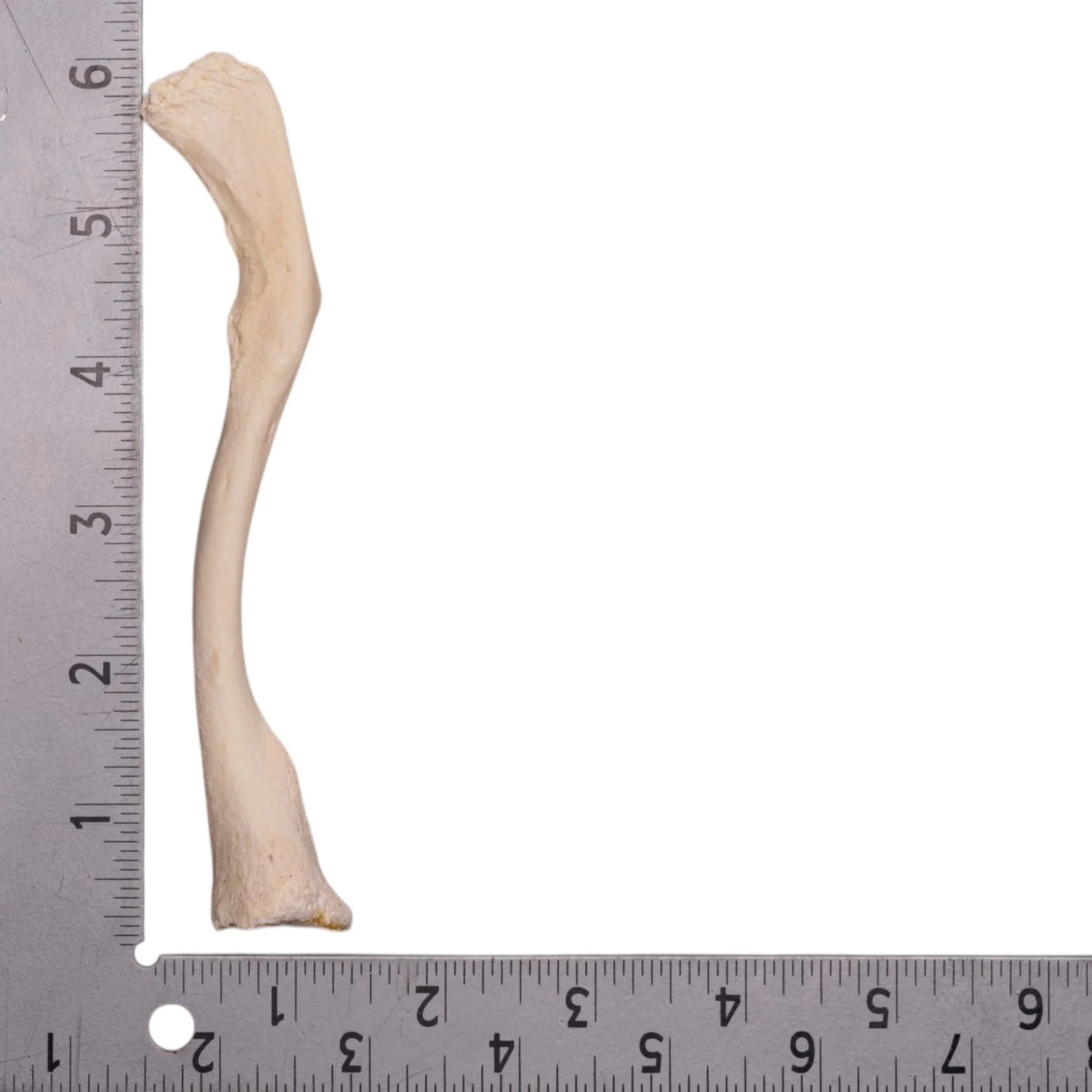 Real Human Clavicle - Pathology - Image 3