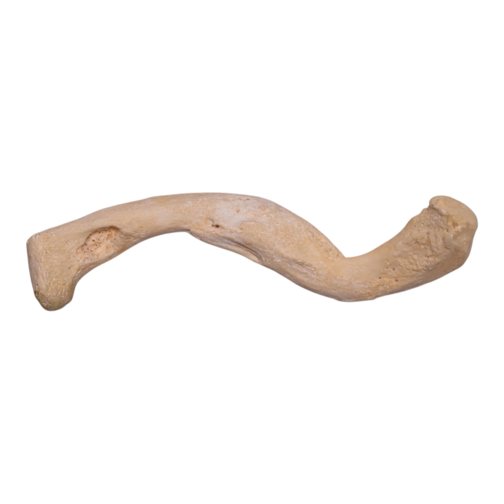 Real Human Clavicle - Pathology - Image 2