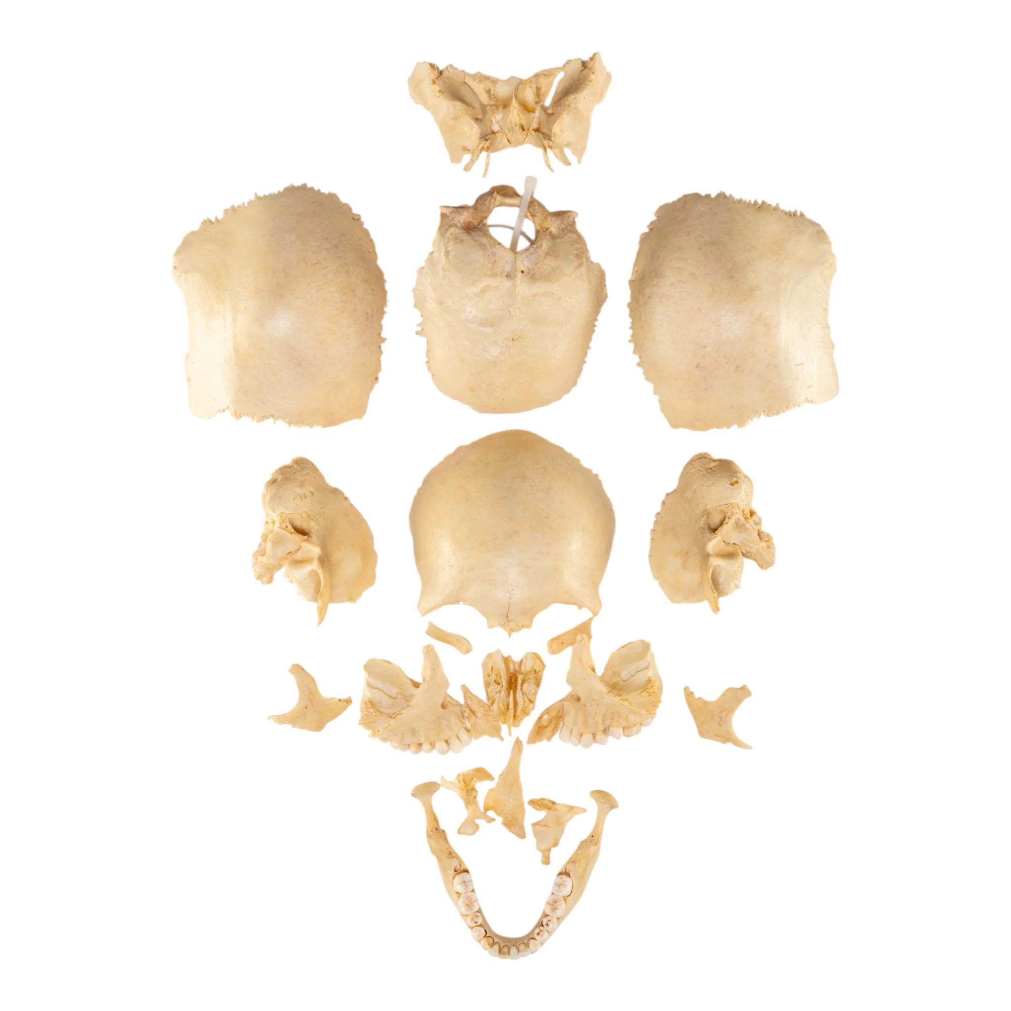 Real Human Skull - Disarticulated