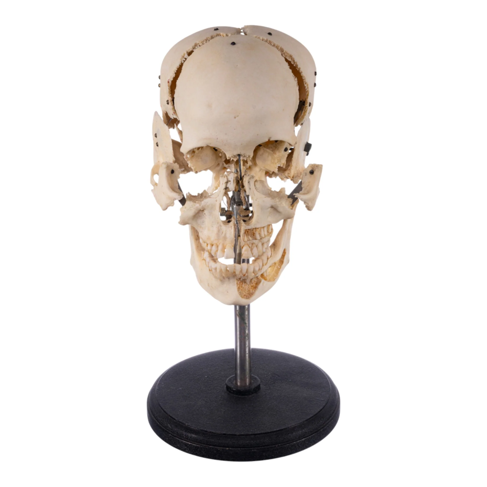 Real Human Exploded Skull on Stand - Image 3