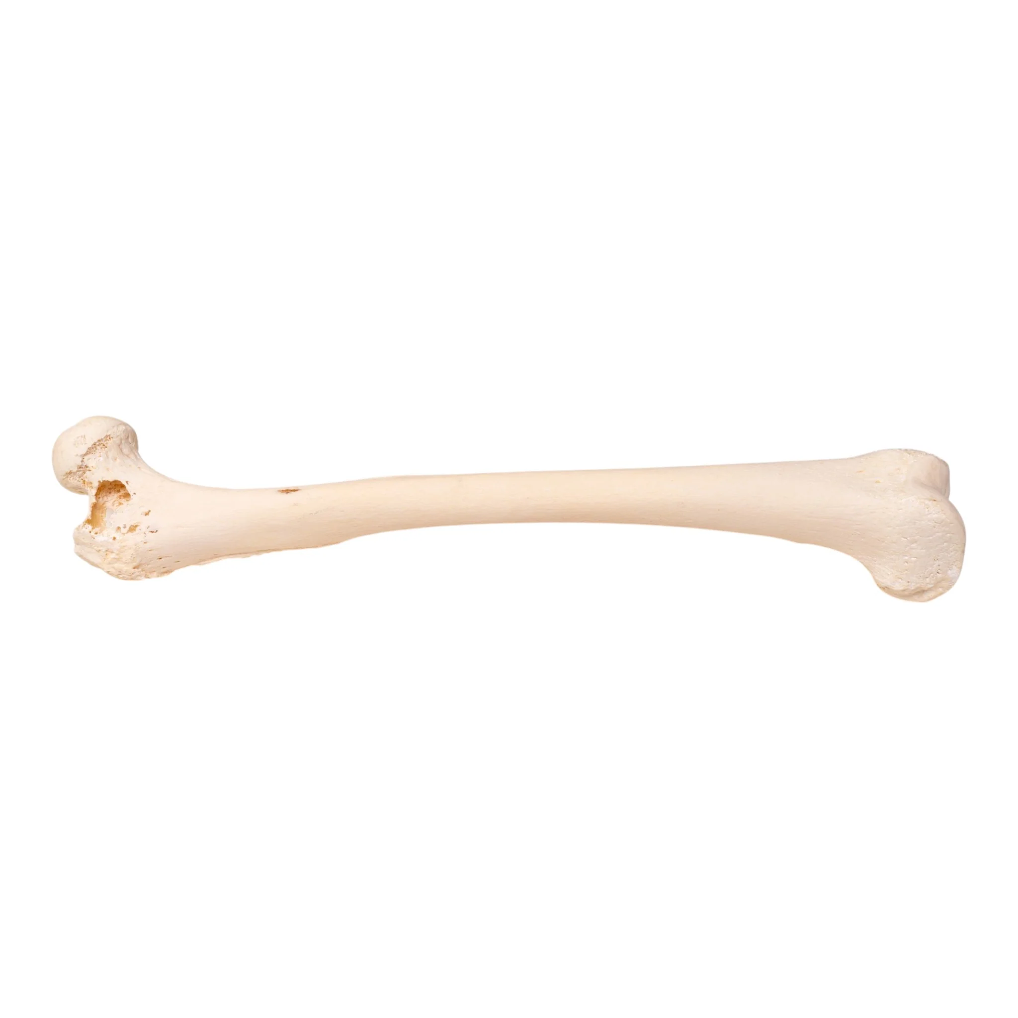 Real Human Femur - Pathology - Image 2