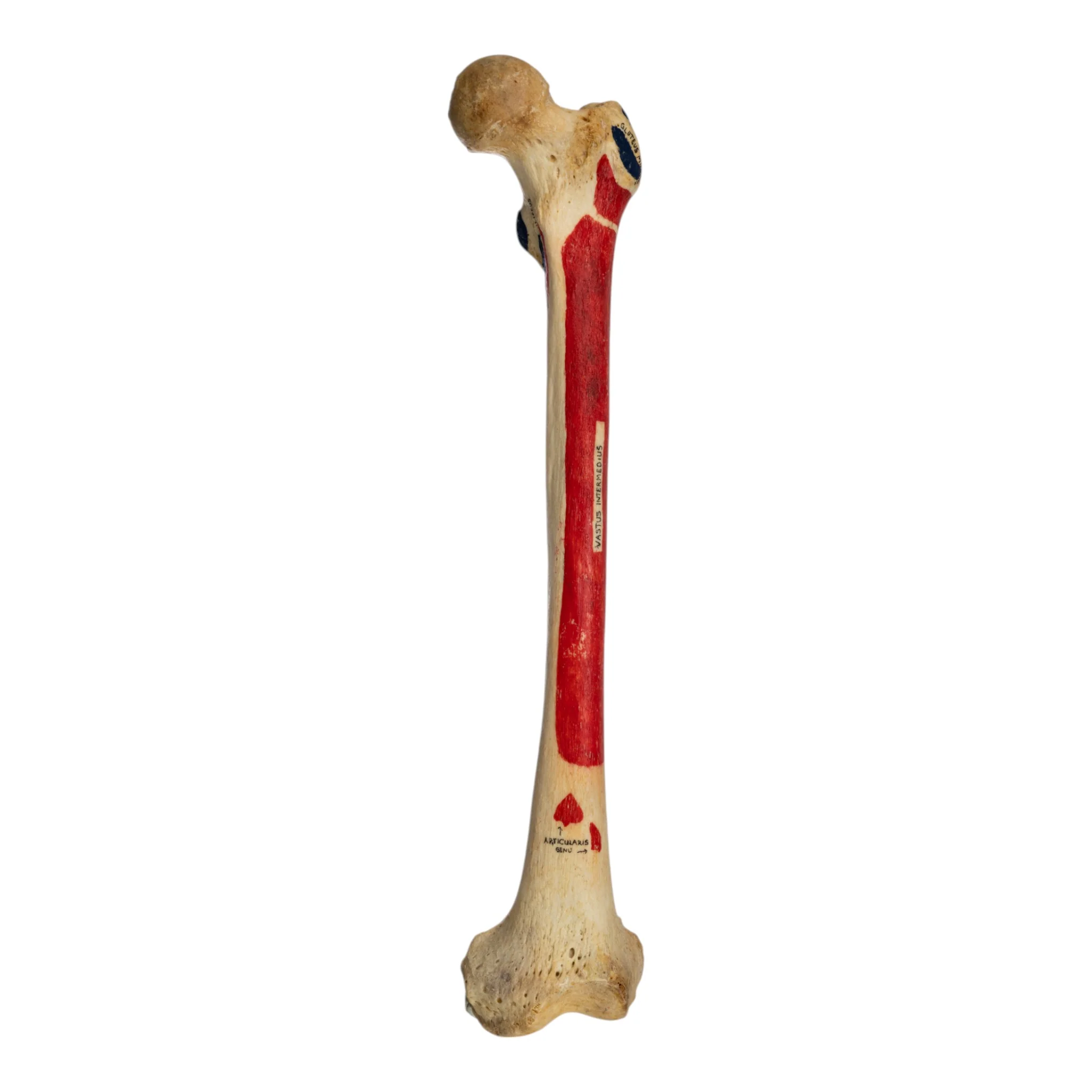 Real Human Femur - Painted - Image 3