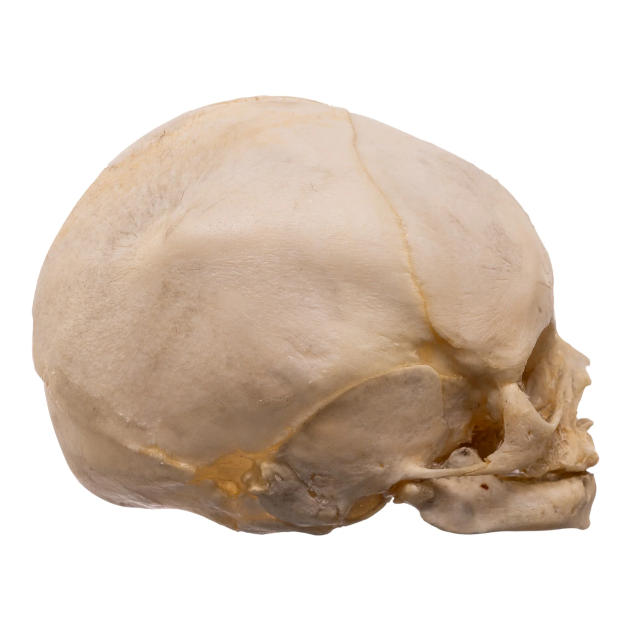 Real Human Fetal Skull - Image 2