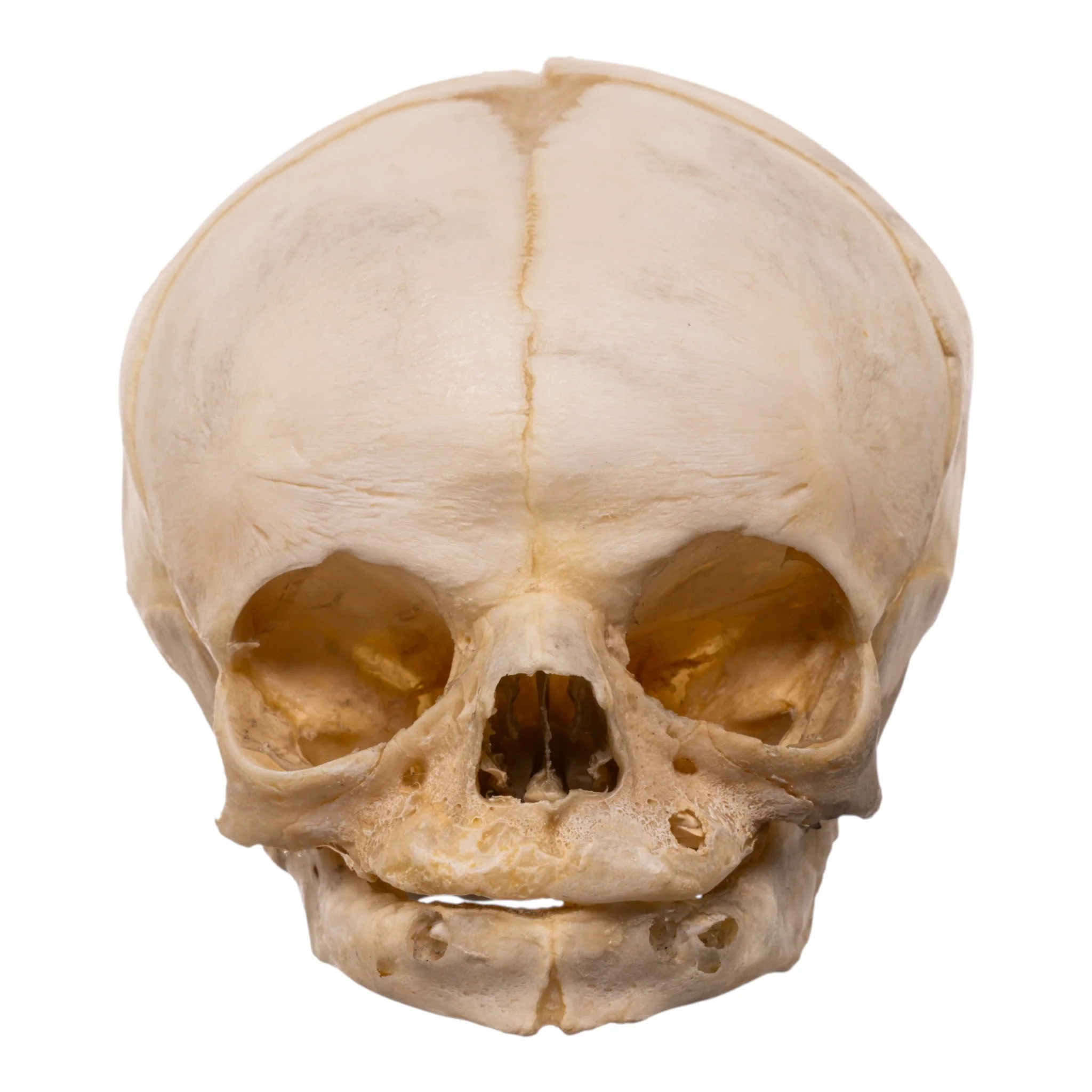 Real Human Fetal Skull - Image 3