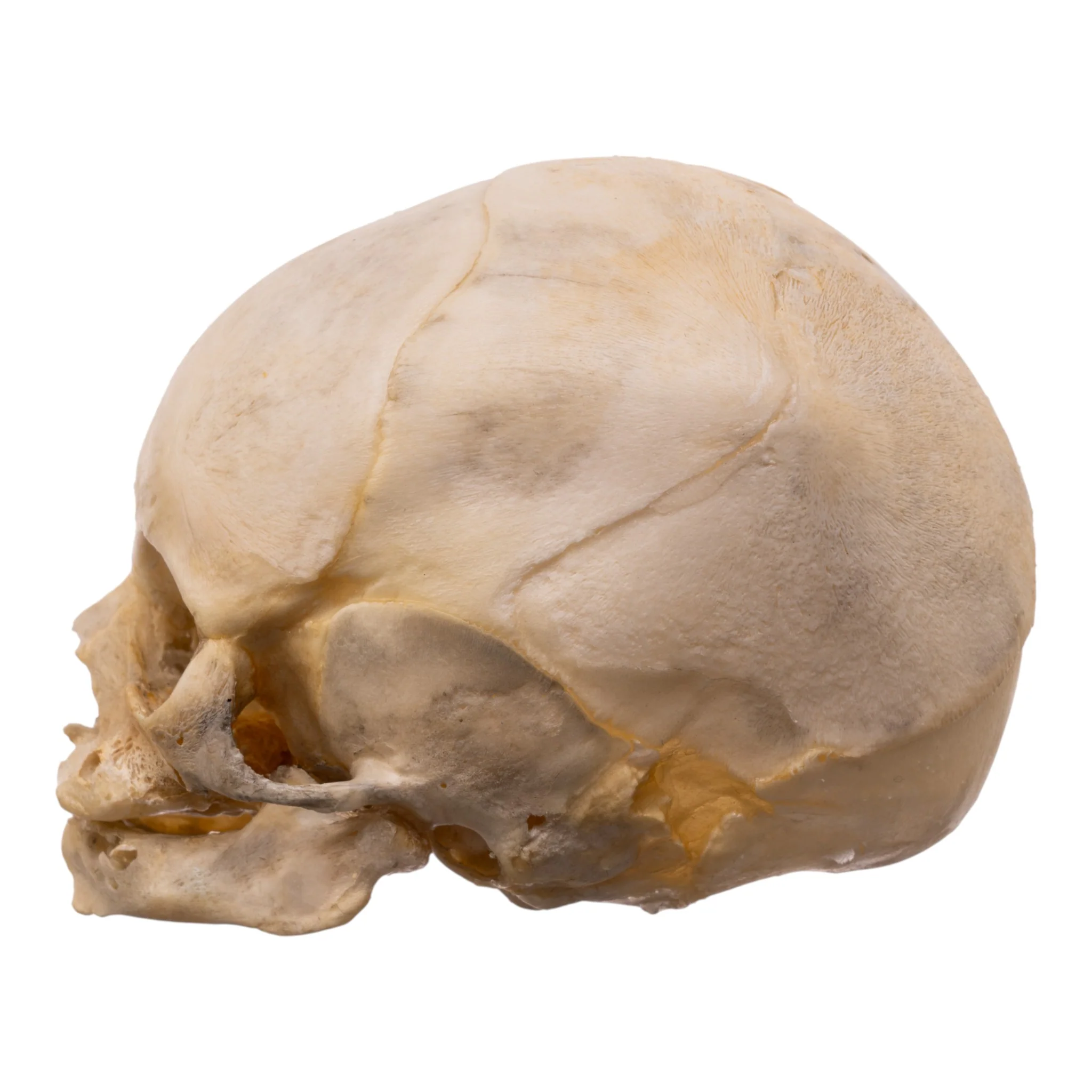 Real Human Fetal Skull - Image 4