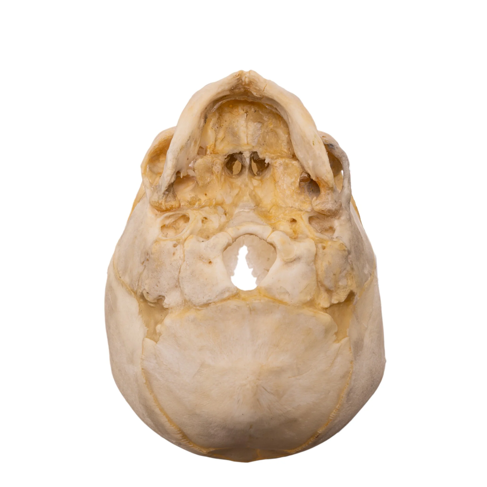 Real Human Fetal Skull - Image 6