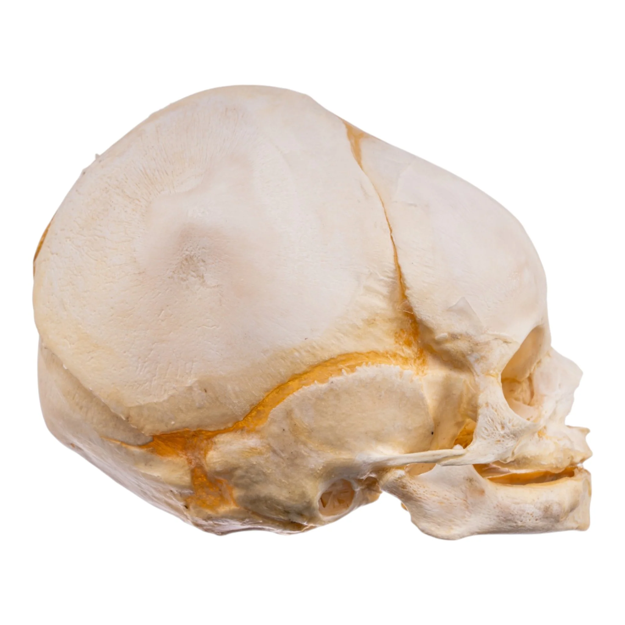 Real Human Fetal Skull - Image 2