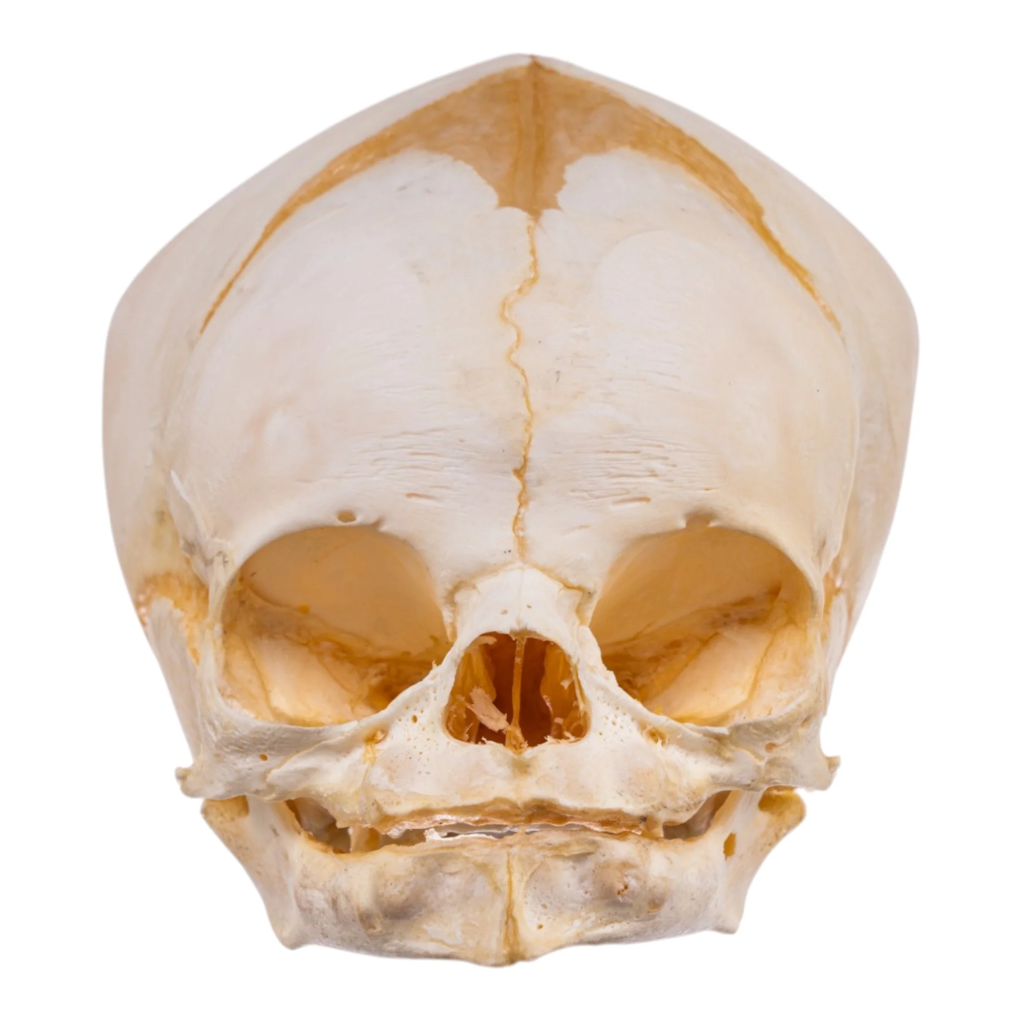 Real Human Fetal Skull - Image 3