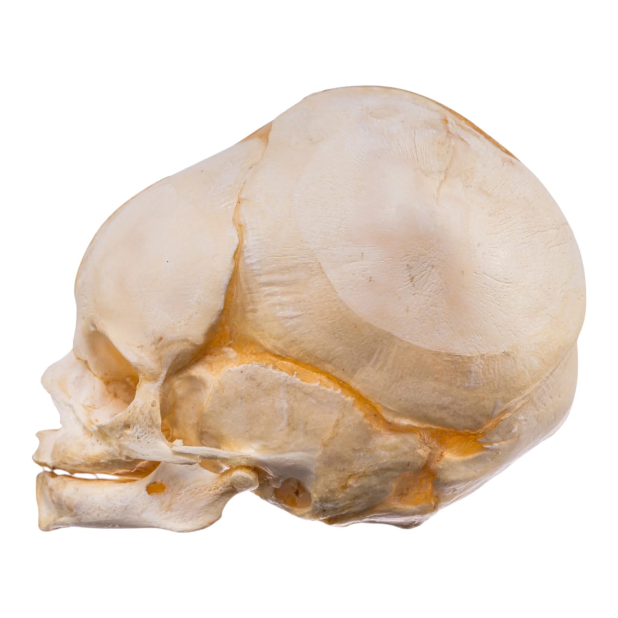 Real Human Fetal Skull - Image 4