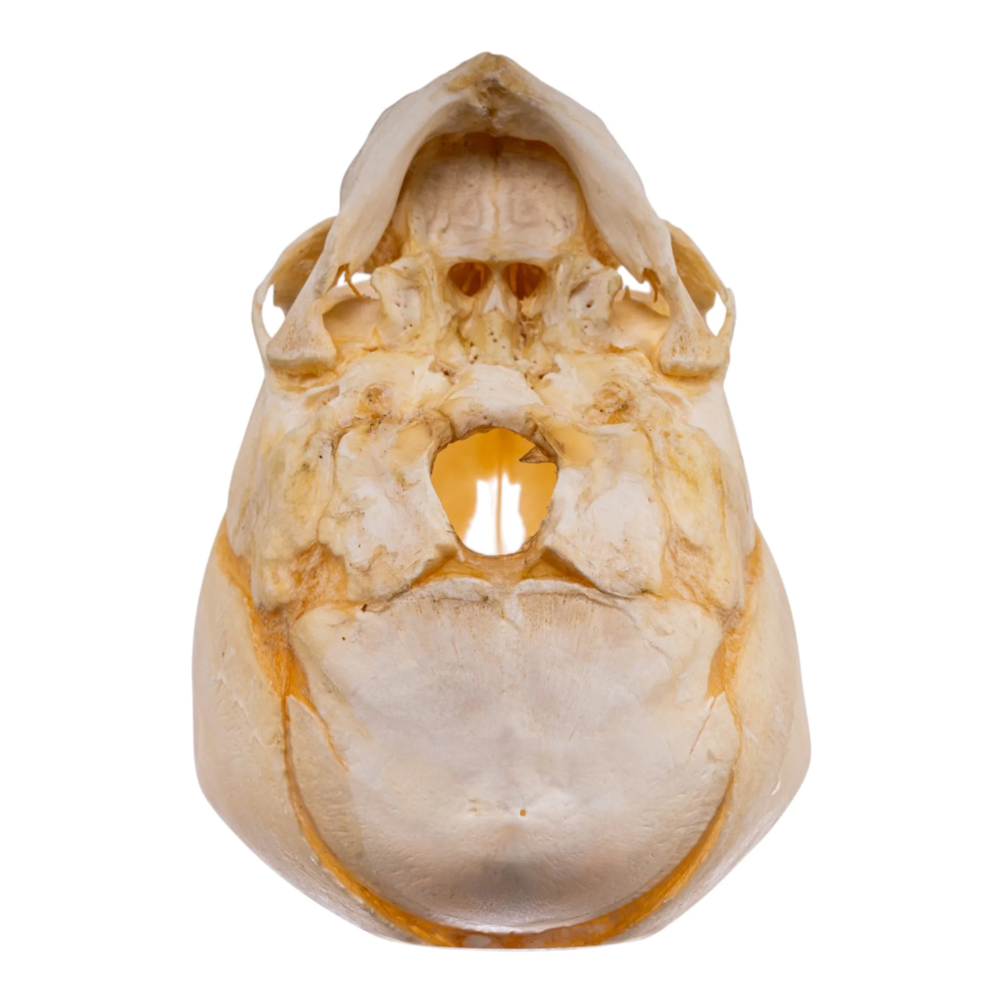 Real Human Fetal Skull - Image 6