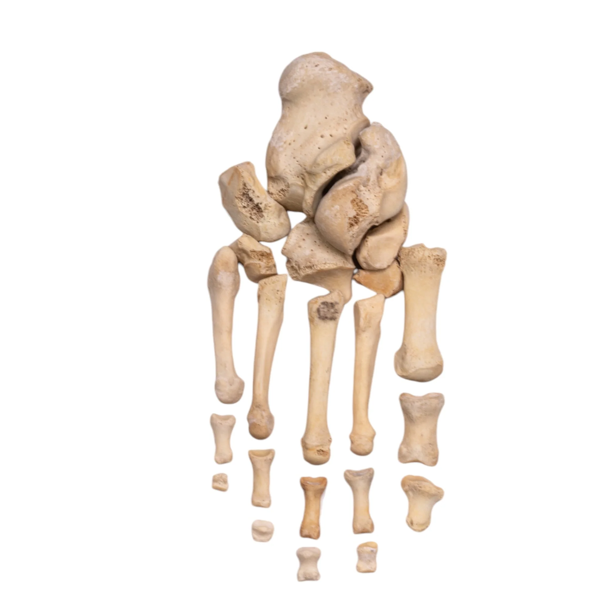 Real Human Foot - Partial Set - Image 4