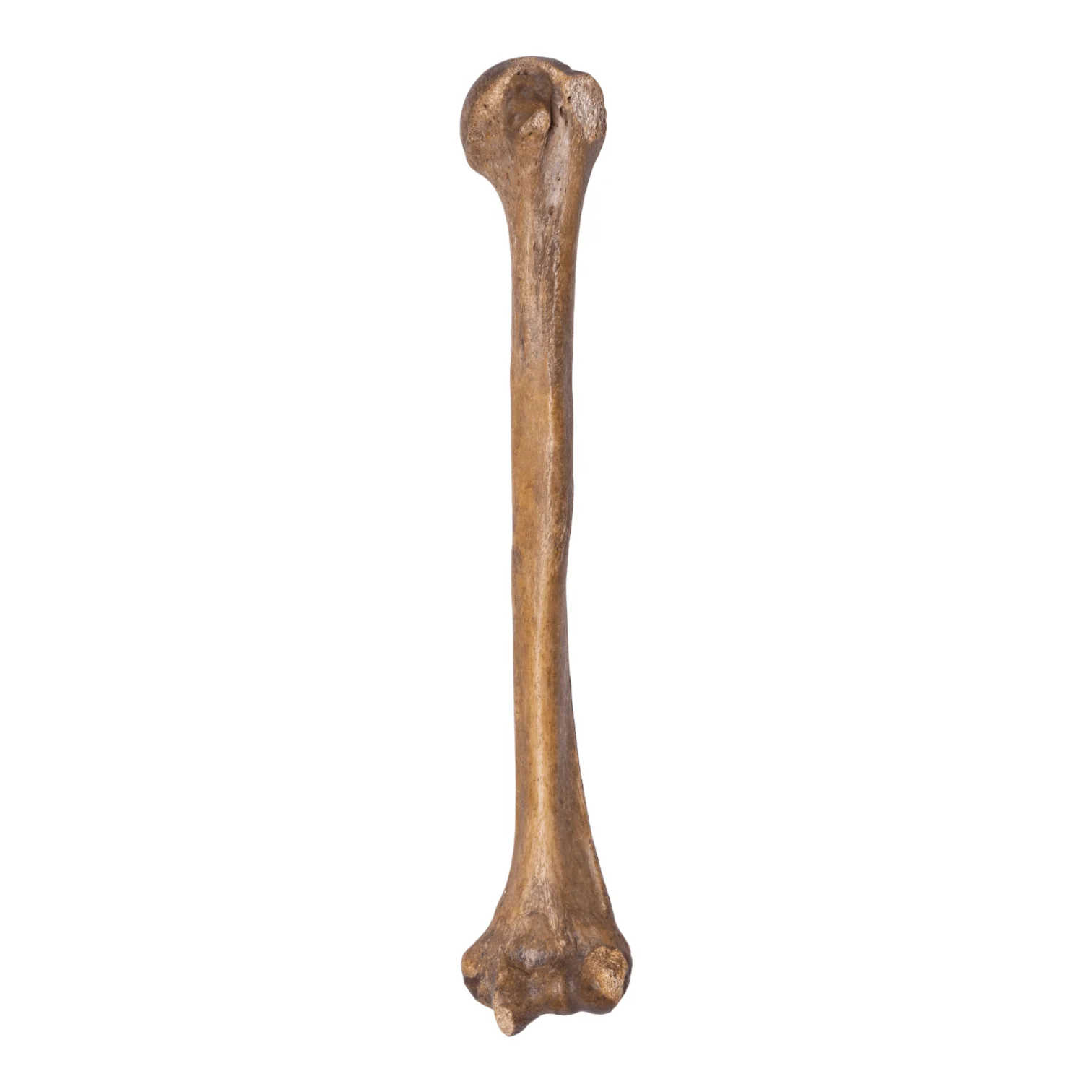 Real Human Humerus - Antique (Single) - Image 6
