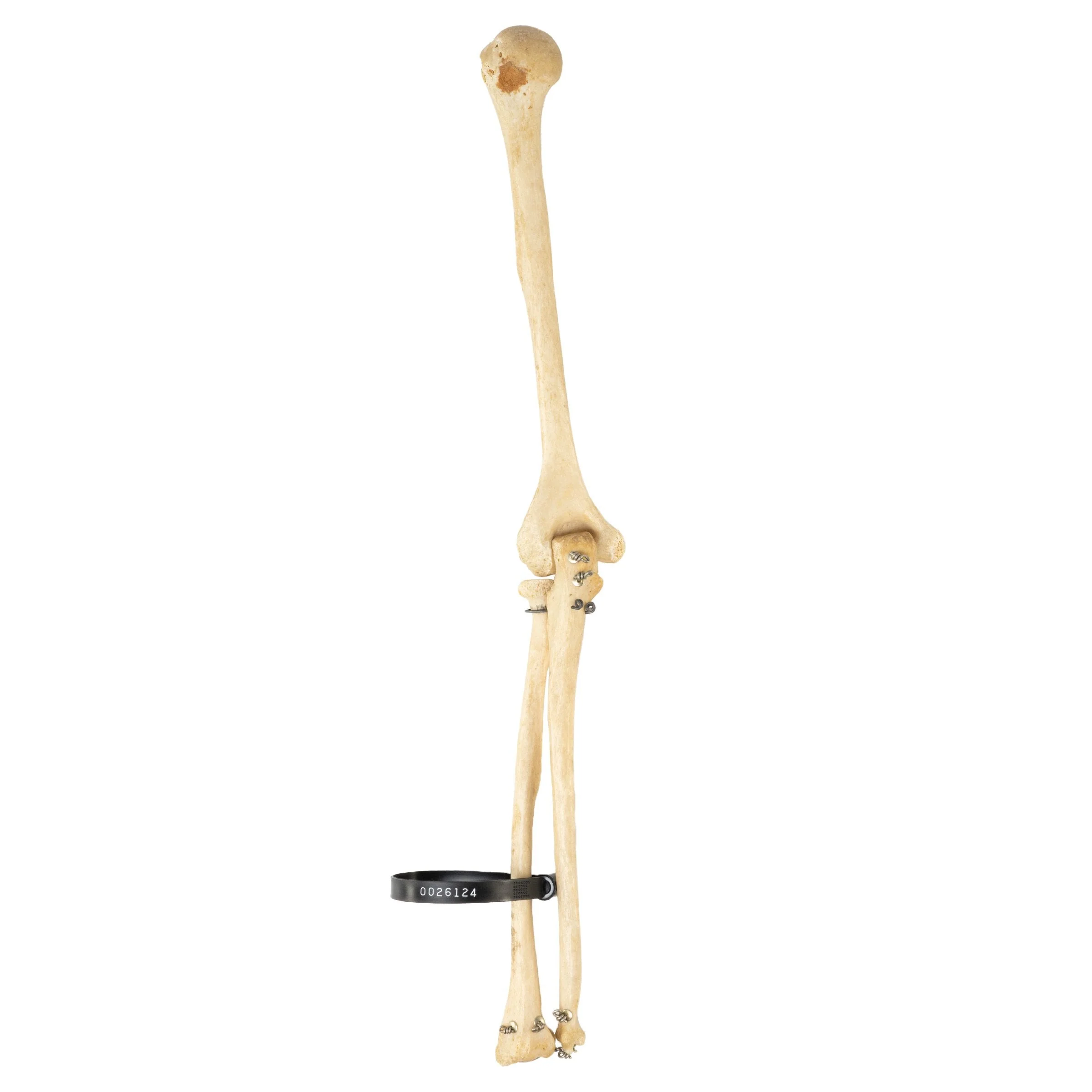 Real Human Humerus, Radius, and Ulna - Image 2