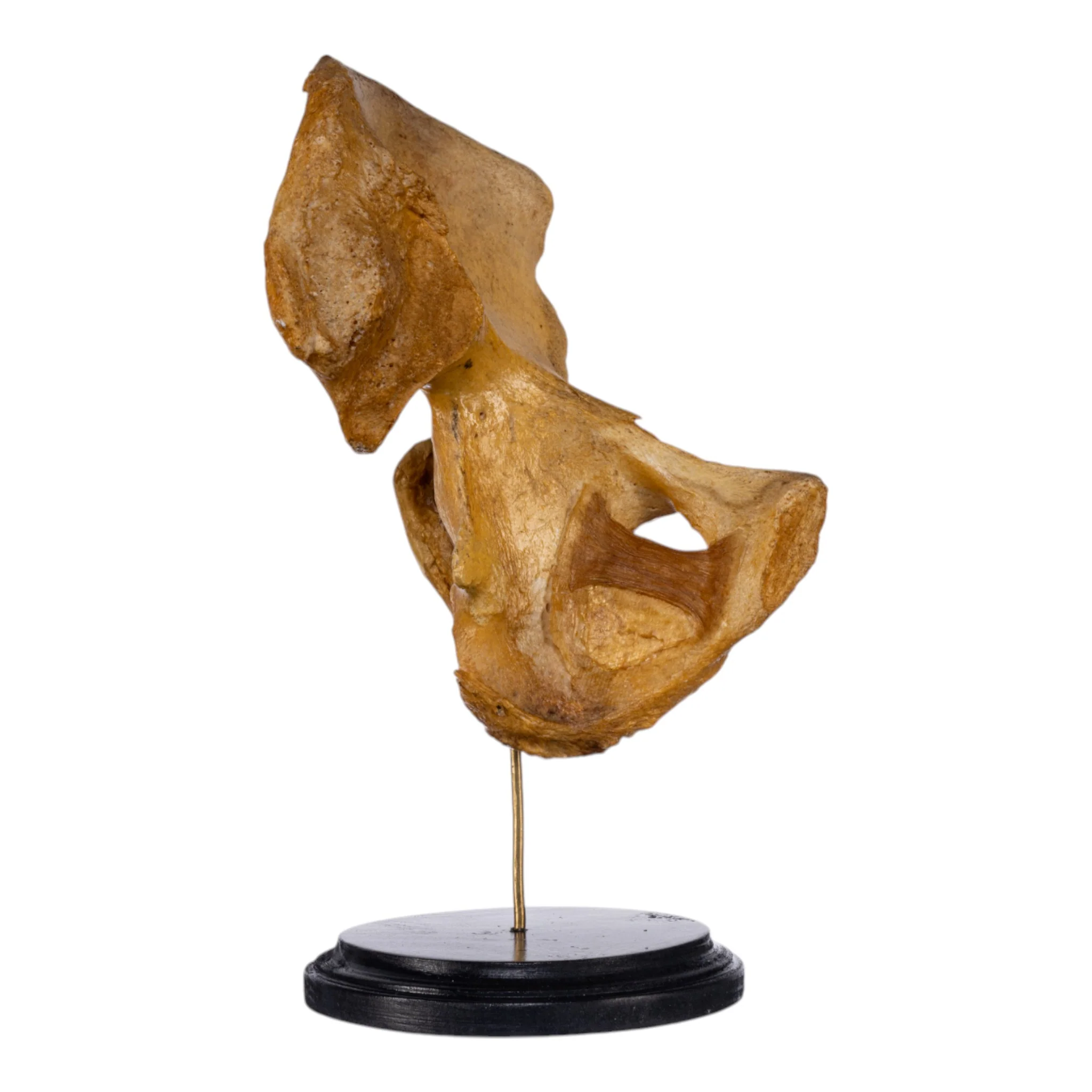 Real Human Left Hip Joint on Stand - Image 2