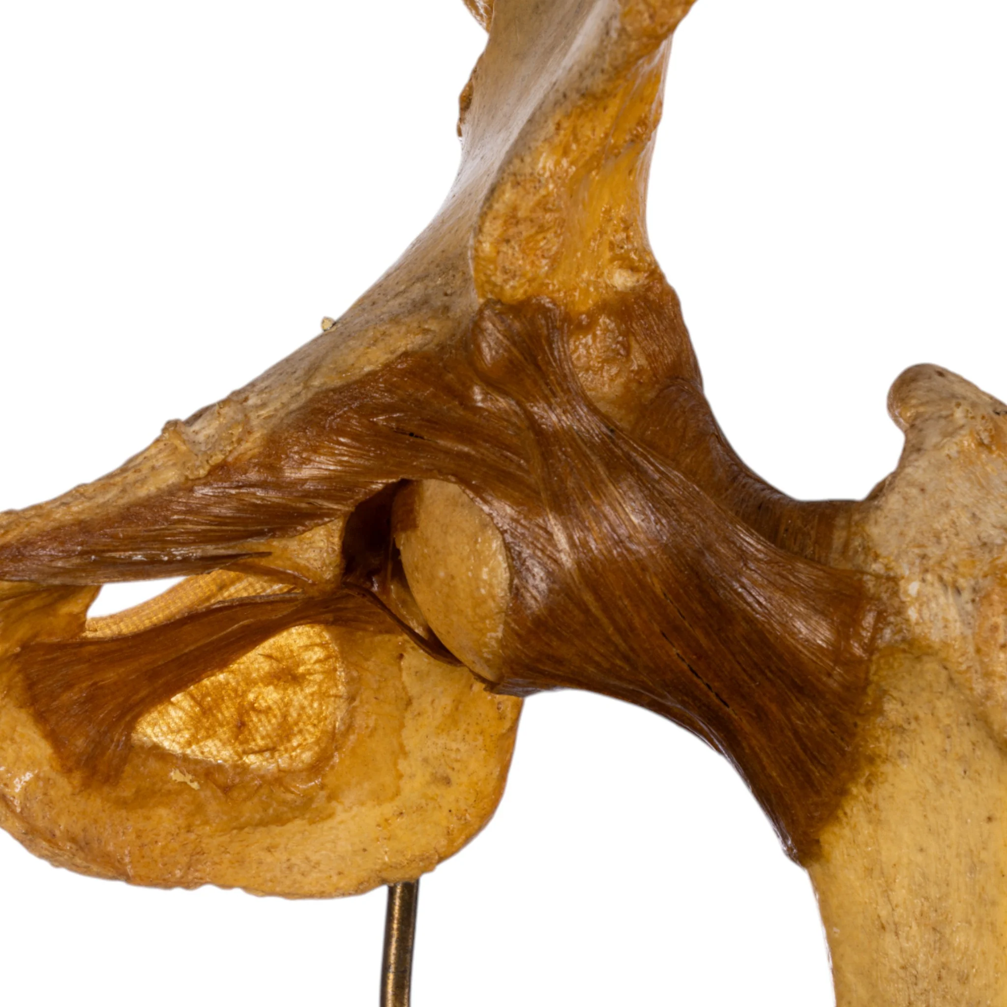 Real Human Left Hip Joint on Stand - Image 5