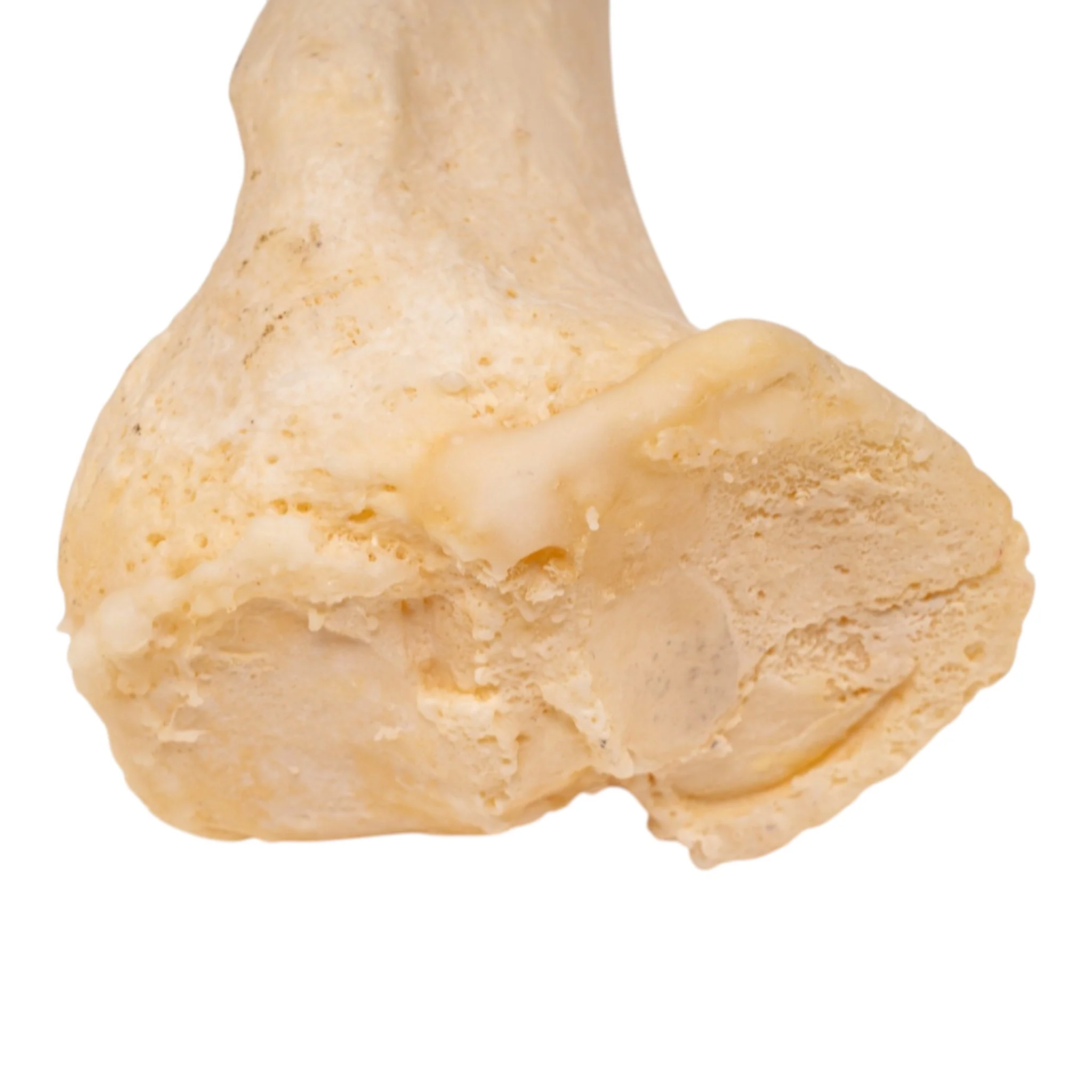 Real Human Left Leg - Pathology - Image 3