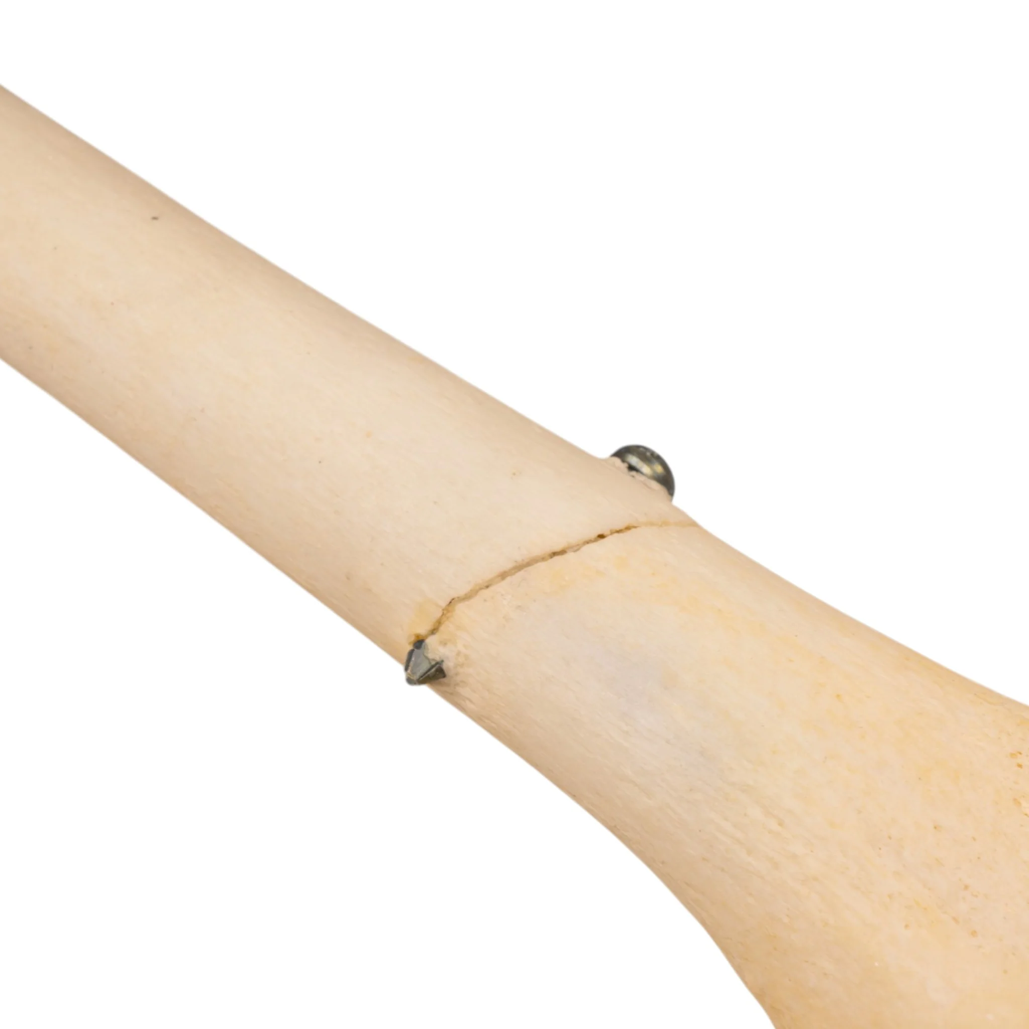 Real Human Left Leg - Pathology - Image 4