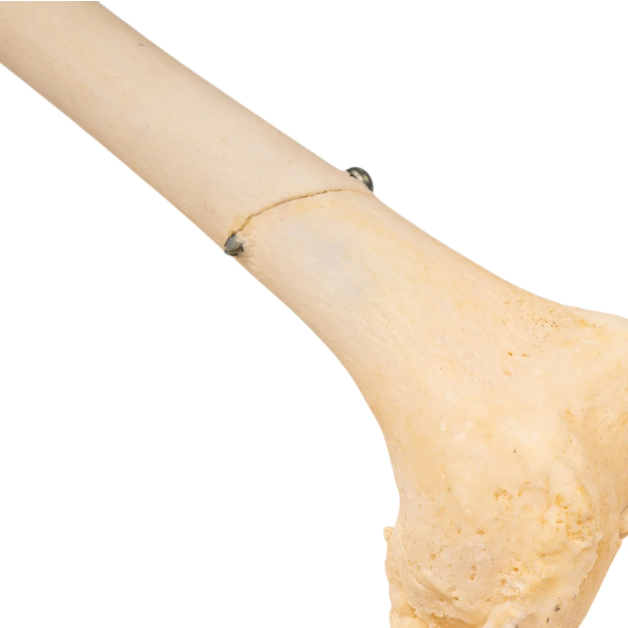 Real Human Left Leg - Pathology - Image 5
