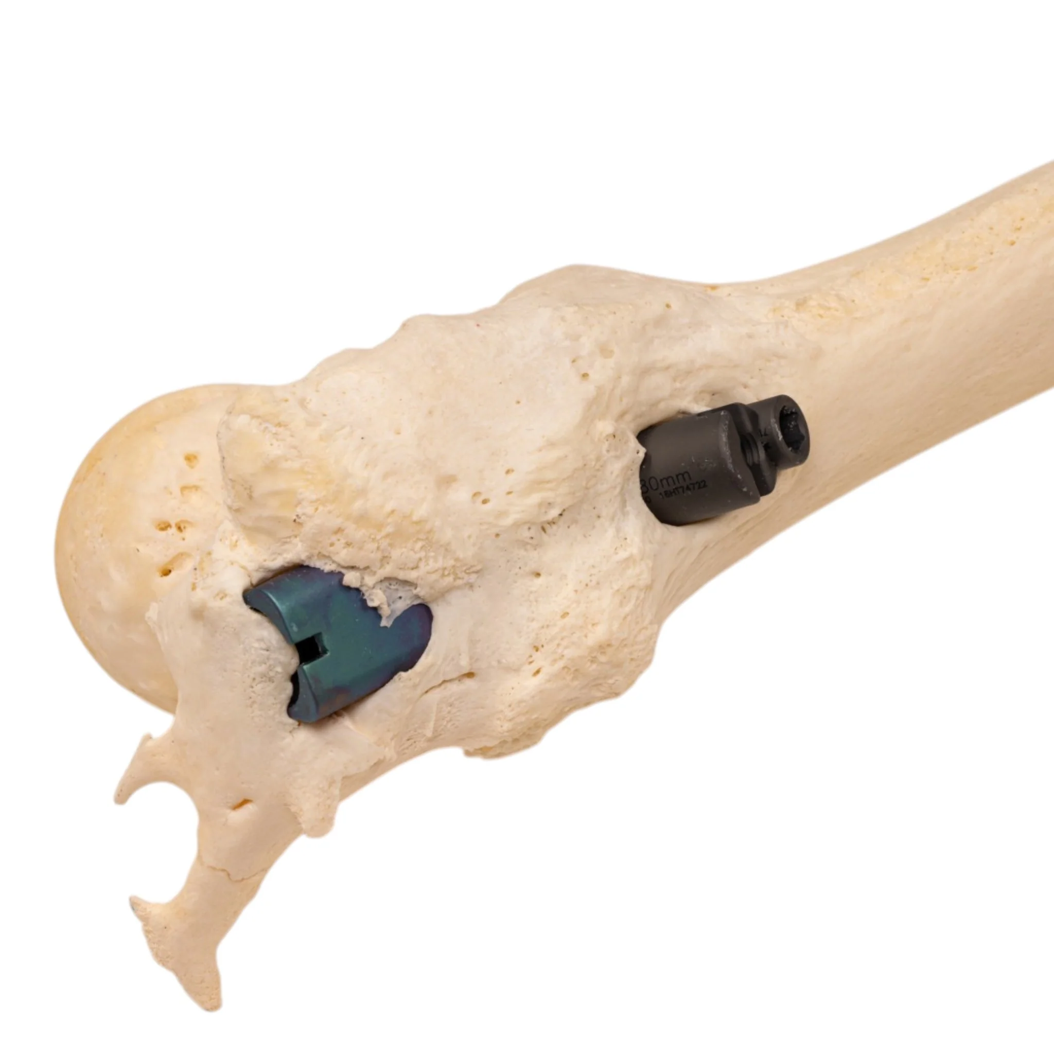 Real Human Left Leg - Pathology - Image 7