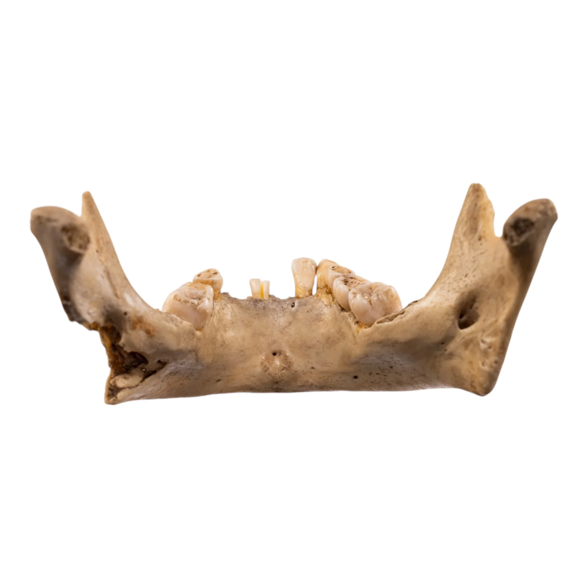 Real Human Mandible - Young - Image 6