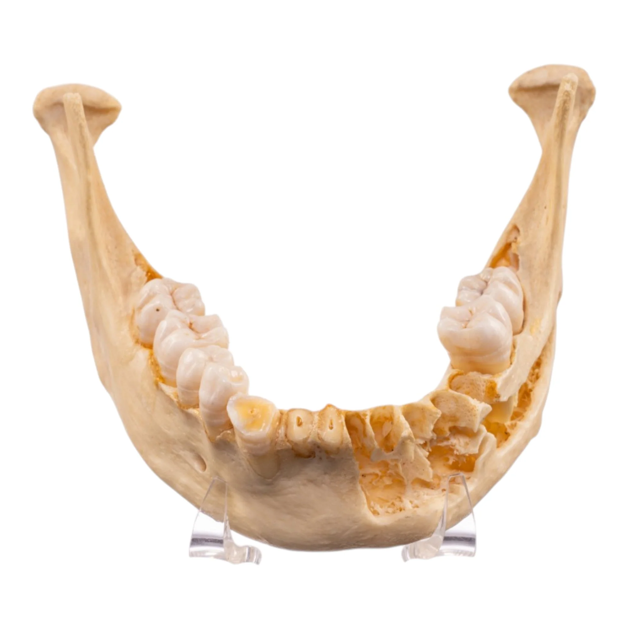 Real Human Mandible - Image 3