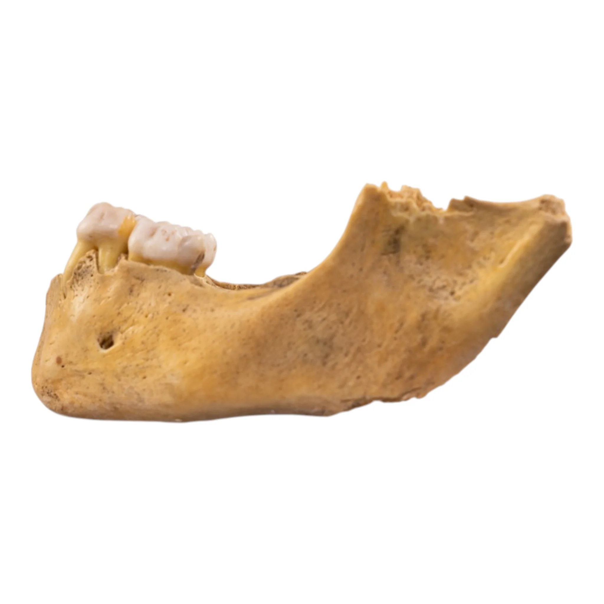 Real Human Mandible - Juvenile - Image 4