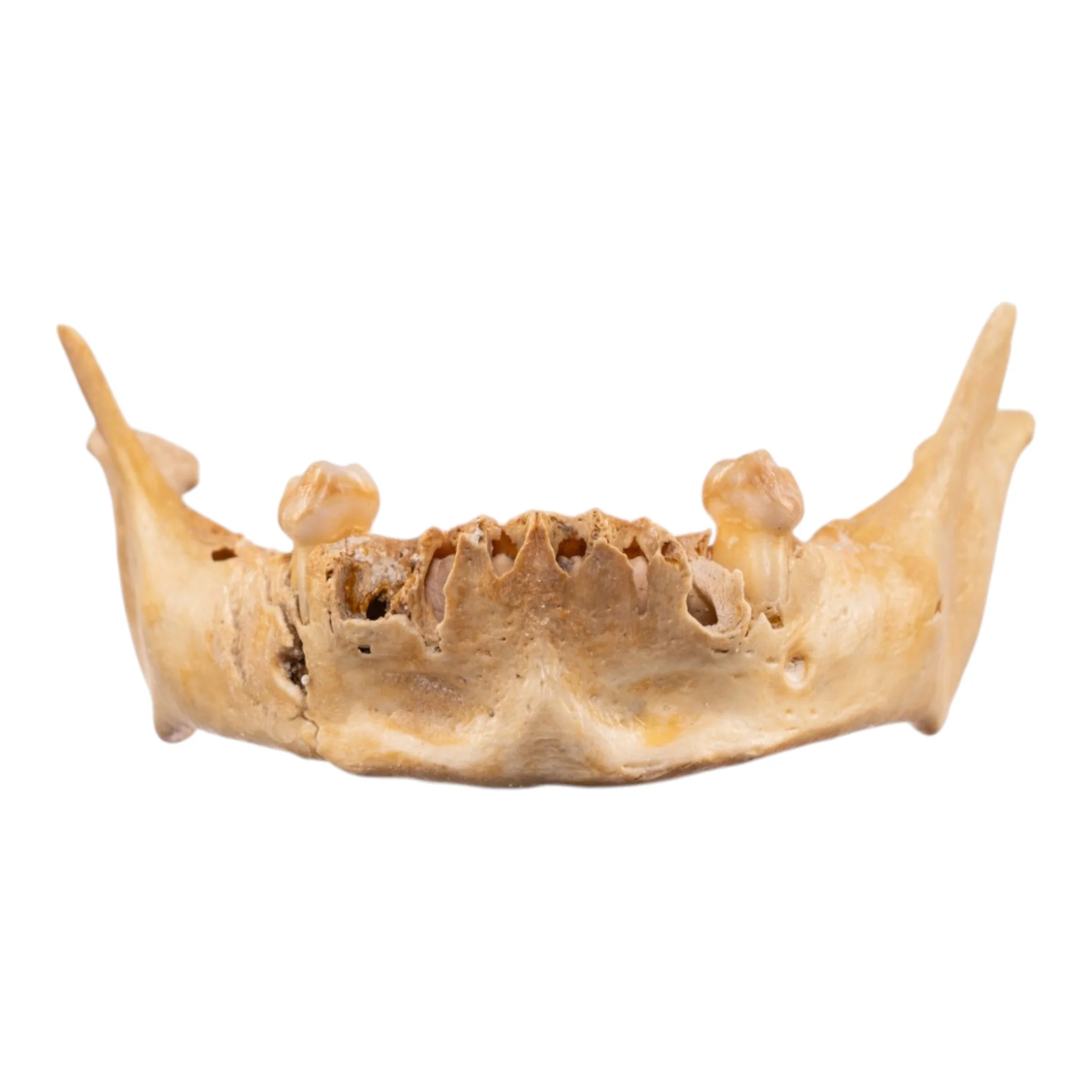Real Human Mandible - Image 2