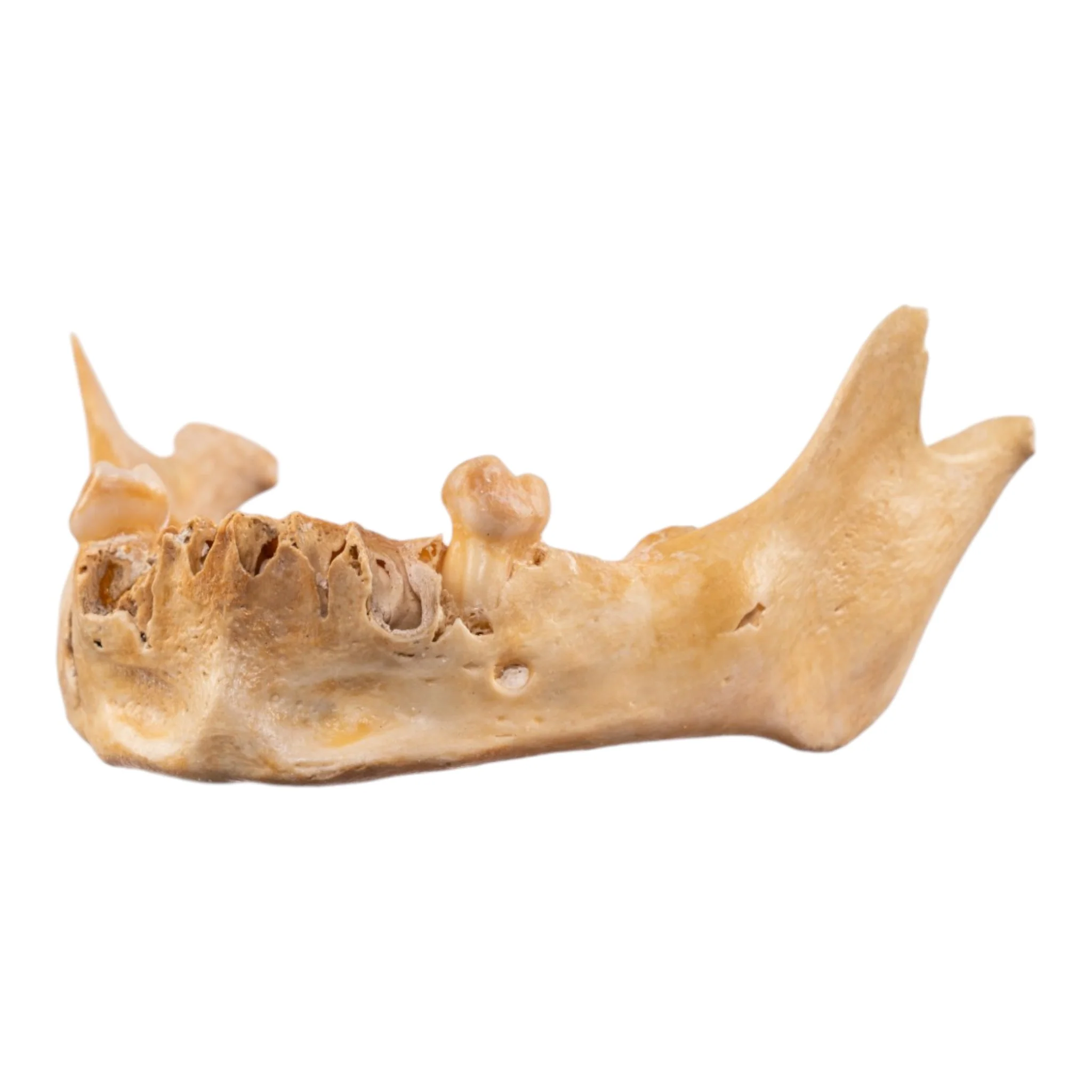 Real Human Mandible - Image 3
