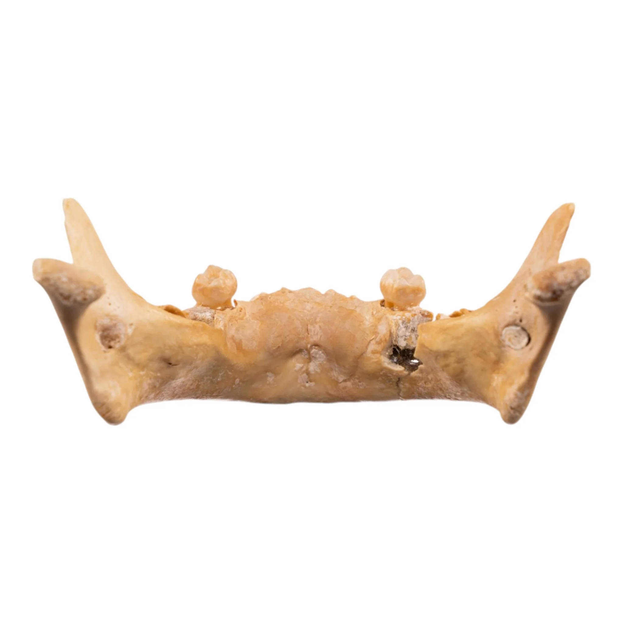 Real Human Mandible - Image 5