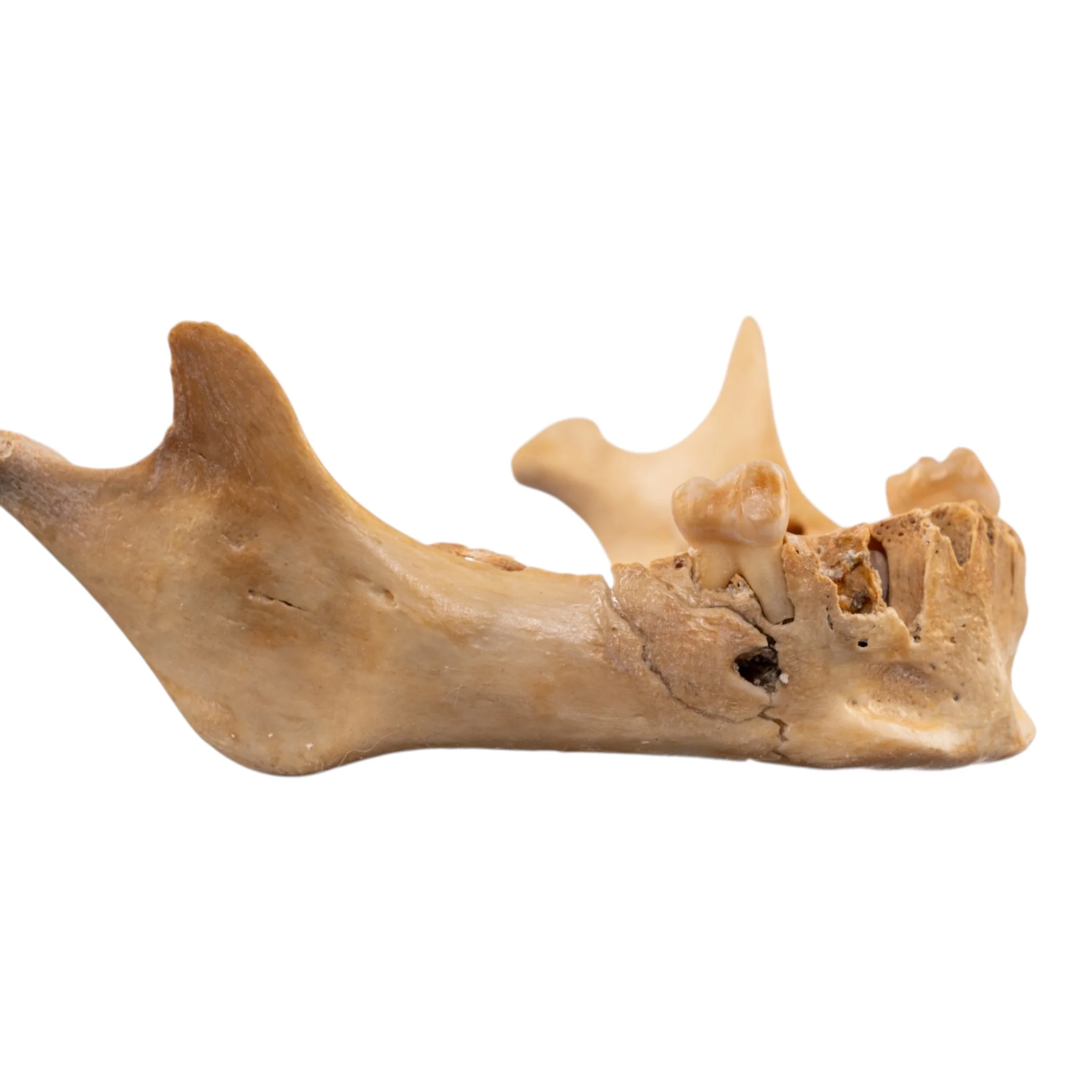 Real Human Mandible - Image 8
