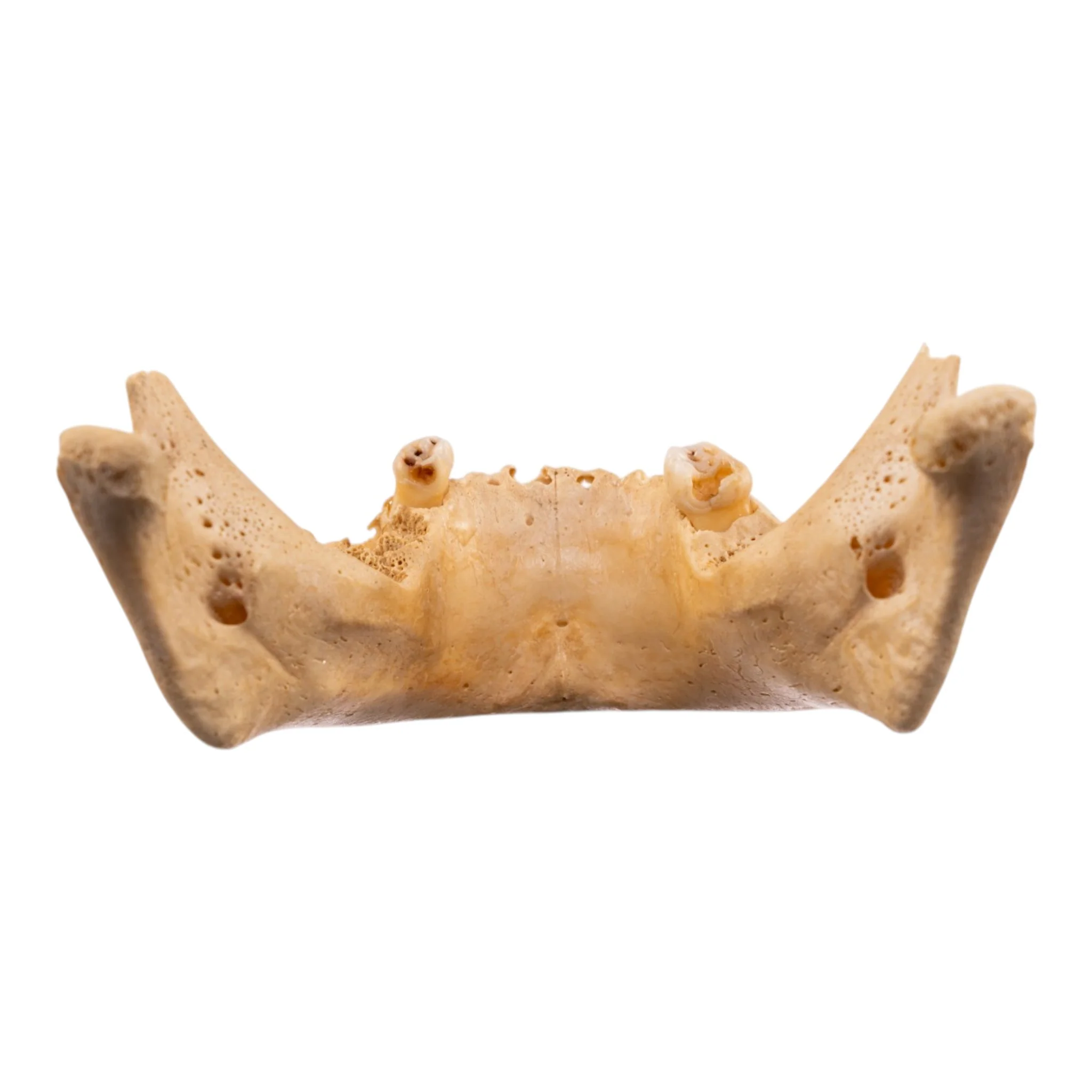 Real Human Mandible - Image 5