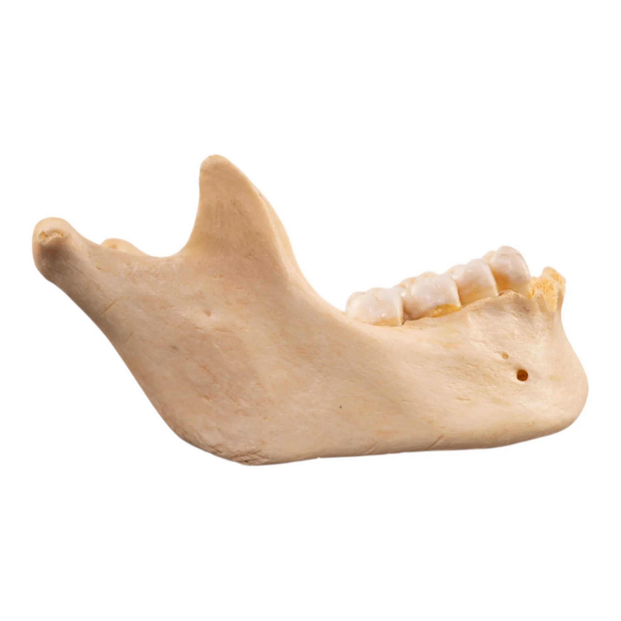 Real Human Mandible - Dissected - Image 2