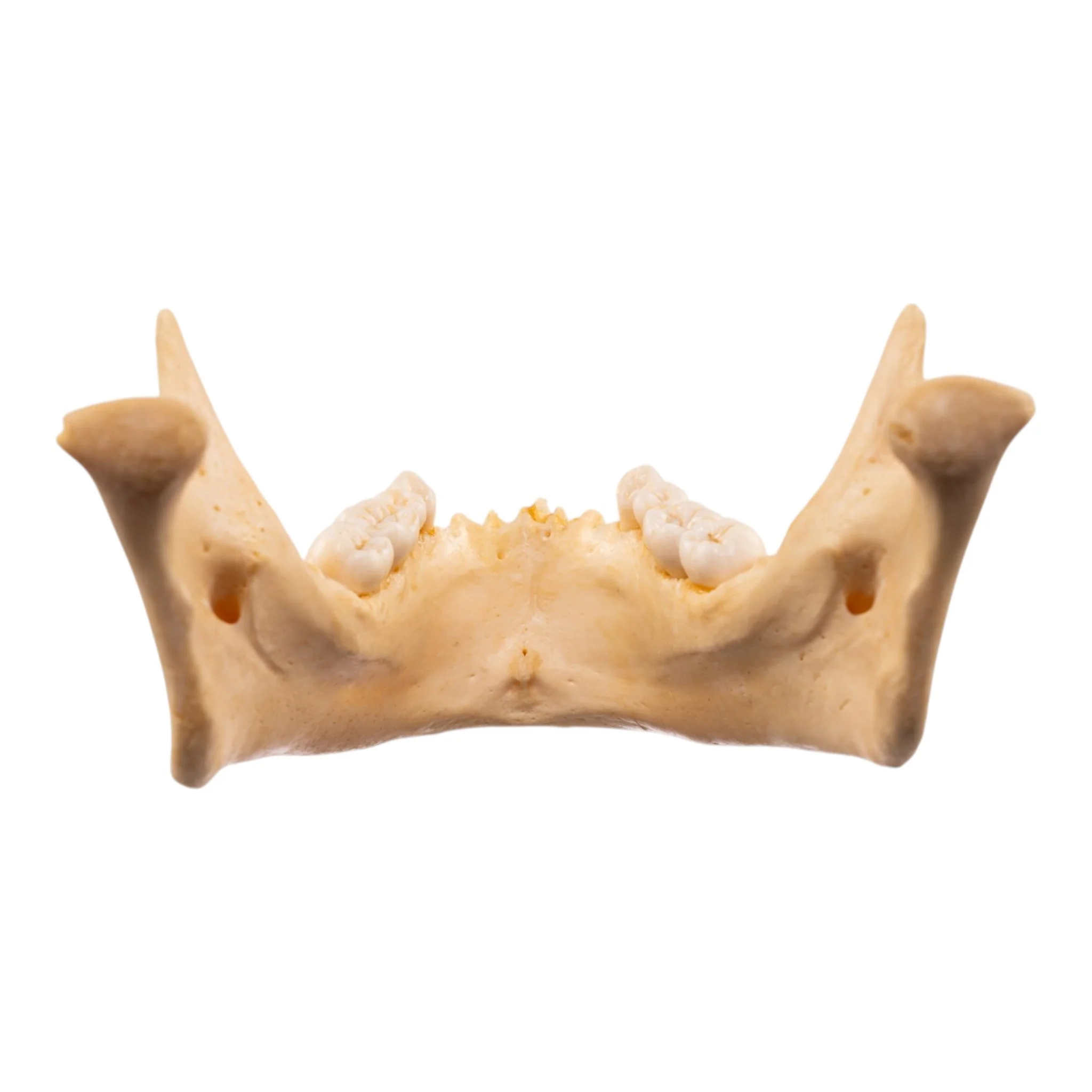 Real Human Mandible - Dissected - Image 5