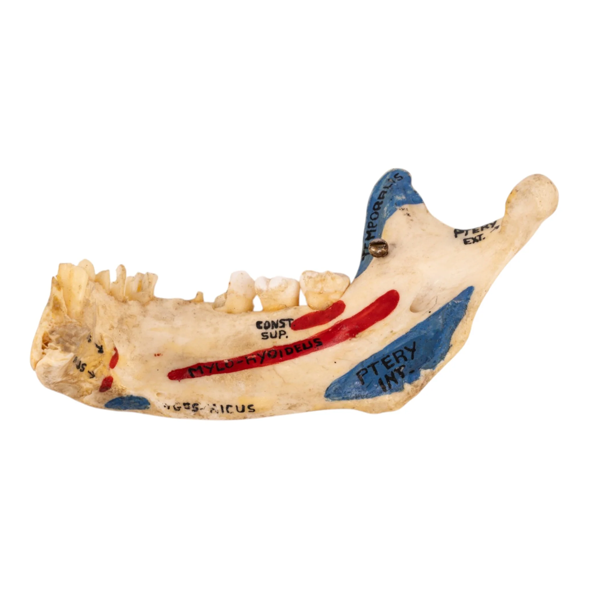 Real Human Partial Mandible - Painted - Image 2